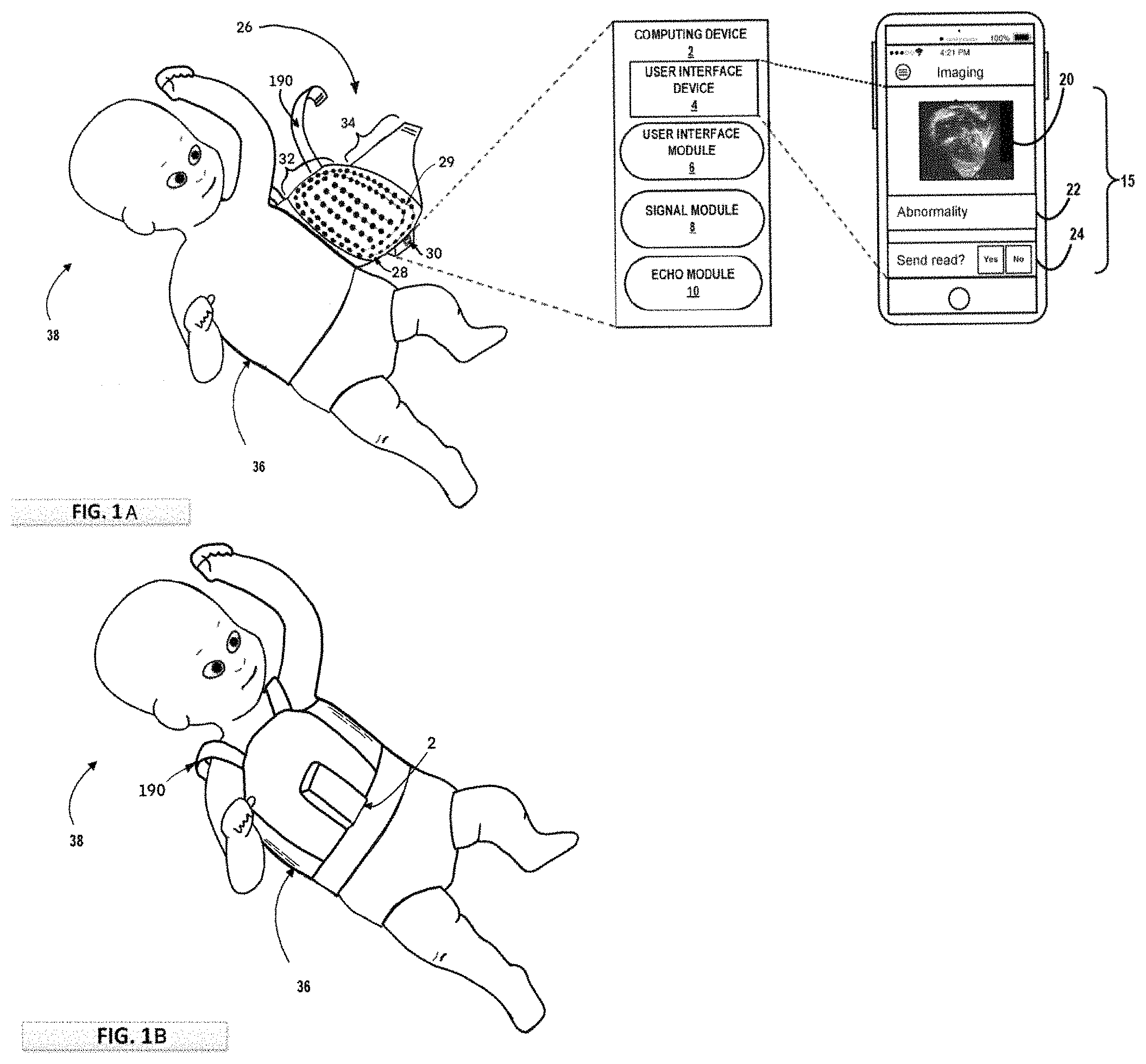 Patent US11793487 Figure 1 – Transducer array device, method and system for cardiac conditions