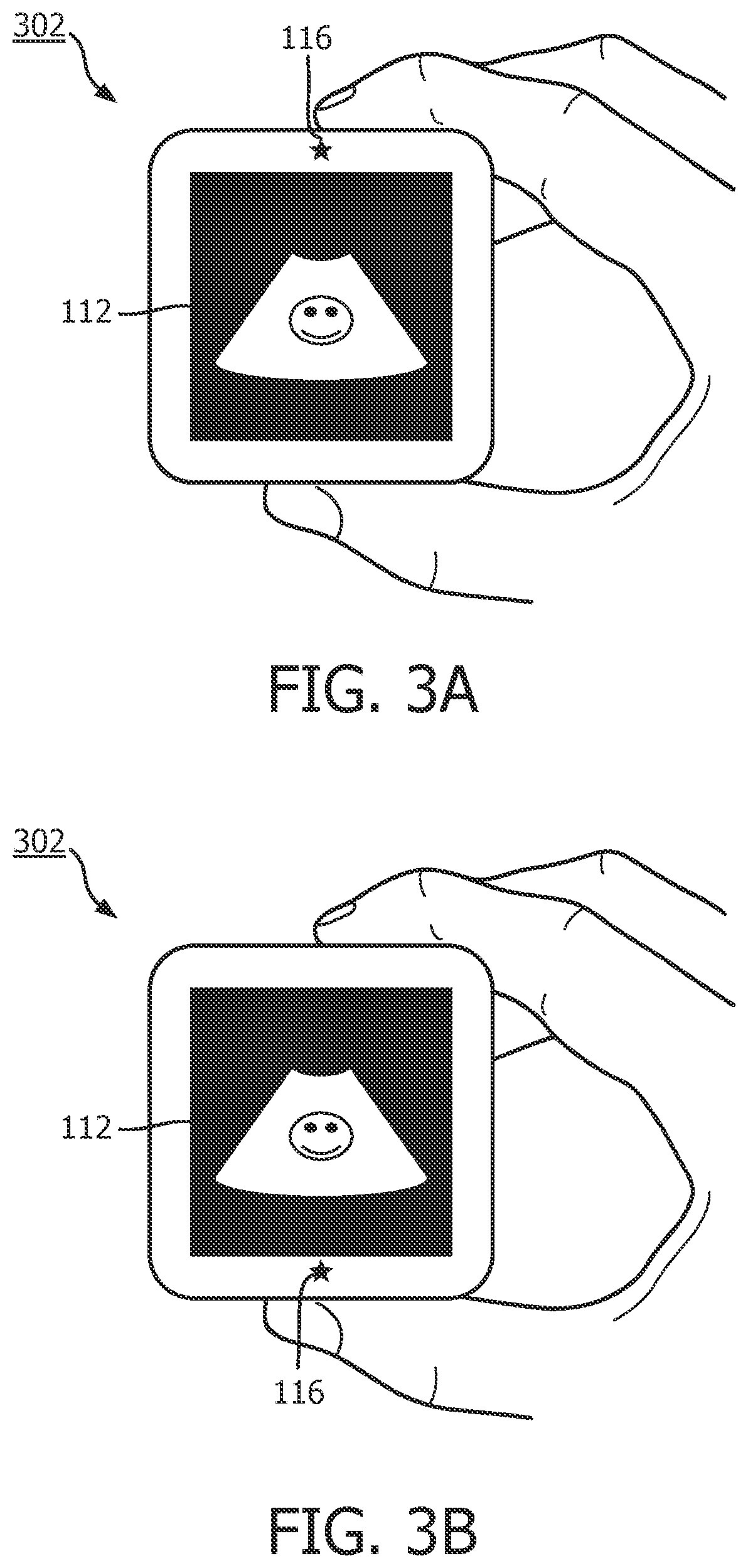 Patent US11793488 Figure 3 – Ergonomic display and activation in handheld medical ultrasound imaging device