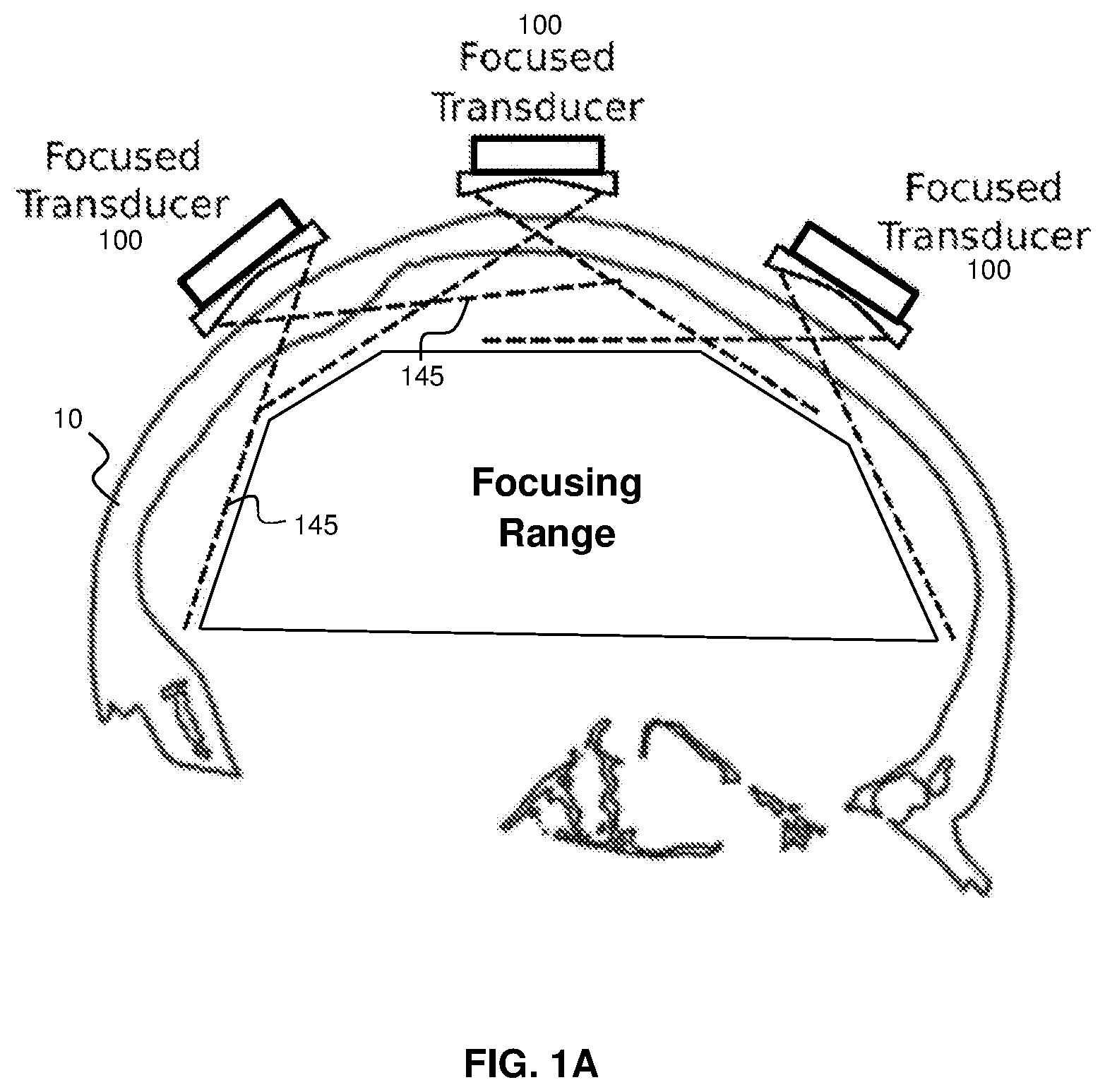 Patent US11793490 — Systems and methods for performing transcranial ultrasound therapeutic and imaging procedures — Figure 1