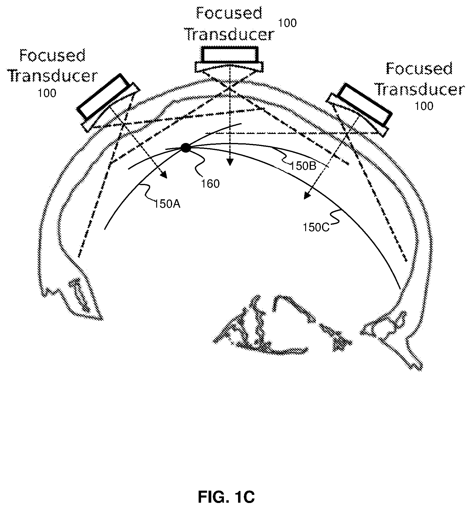 Patent US11793490 Figure 3 – Systems and methods for performing transcranial ultrasound therapeutic and imaging procedures