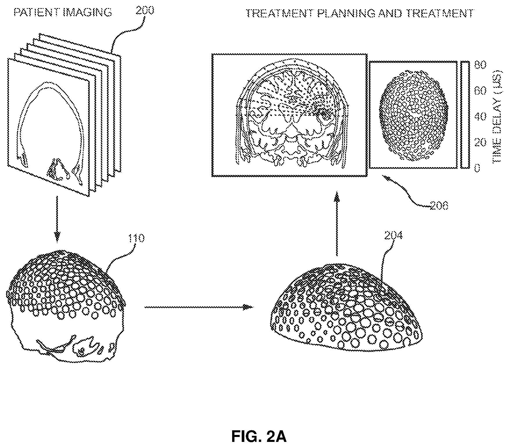 Patent US11793490 Figure 4 – Systems and methods for performing transcranial ultrasound therapeutic and imaging procedures