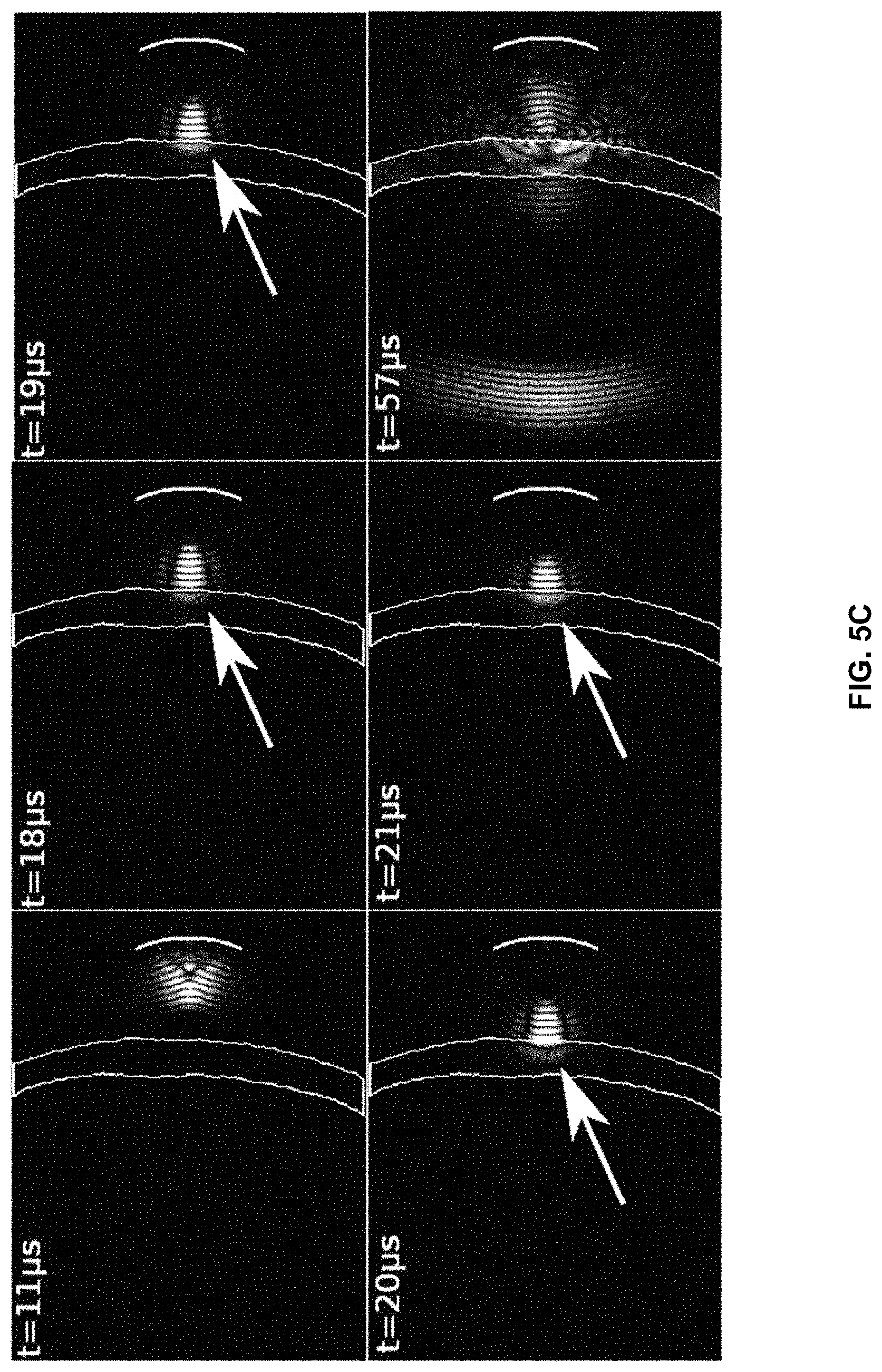 Patent US11793490 Figure 9 – Systems and methods for performing transcranial ultrasound therapeutic and imaging procedures