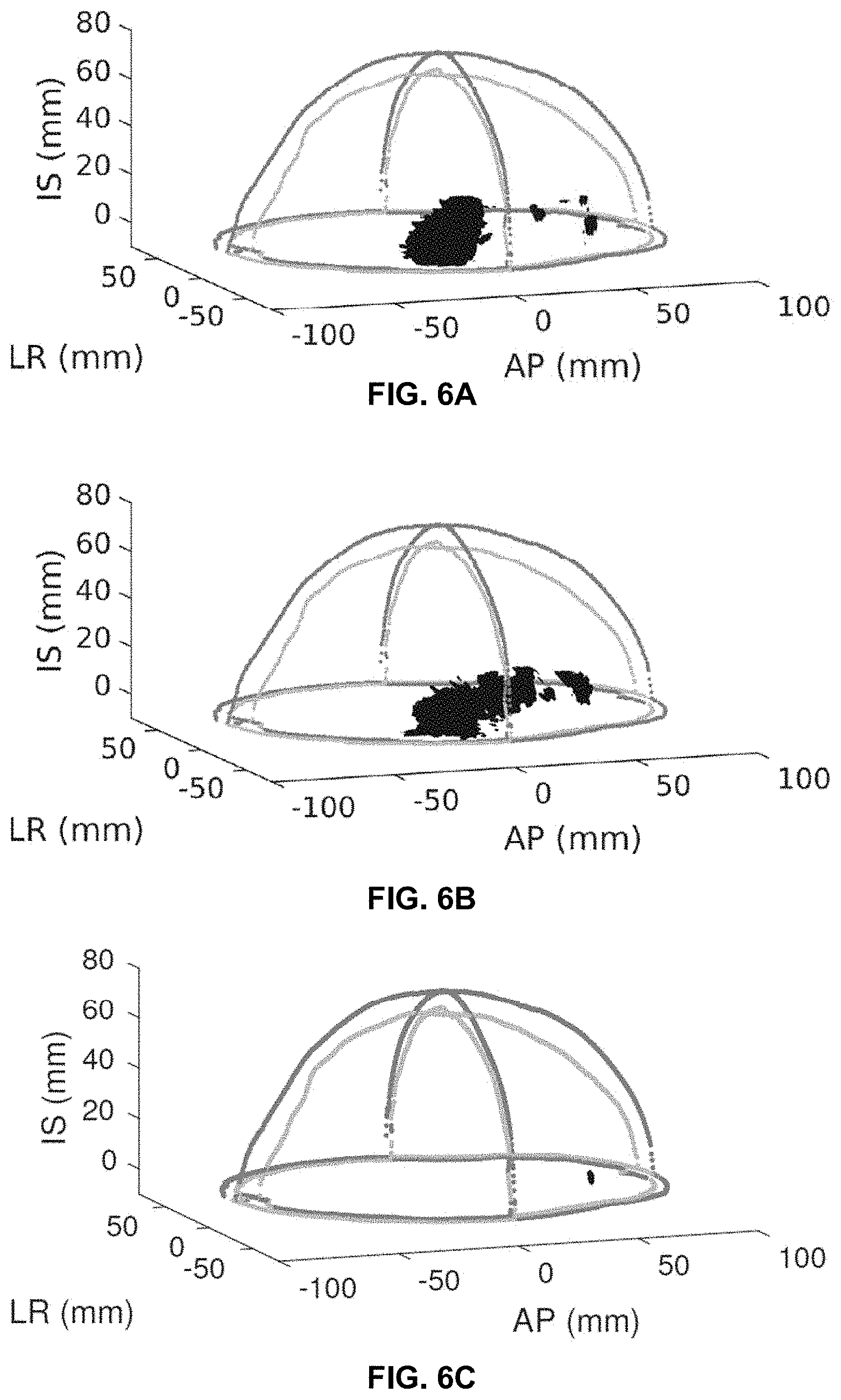 Patent US11793490 Figure 10 – Systems and methods for performing transcranial ultrasound therapeutic and imaging procedures
