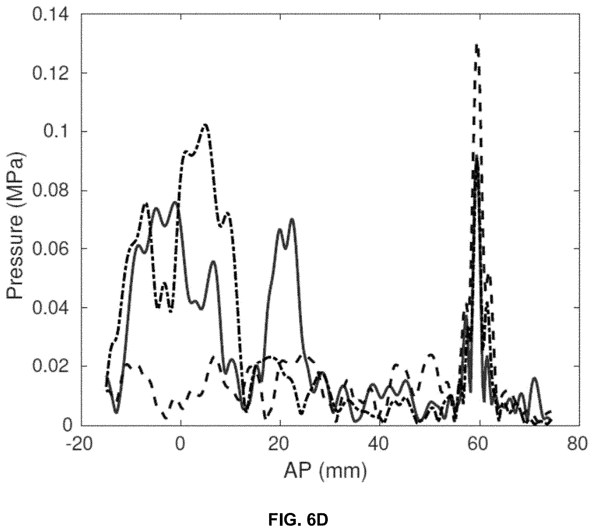 Patent US11793490 Figure 11 – Systems and methods for performing transcranial ultrasound therapeutic and imaging procedures