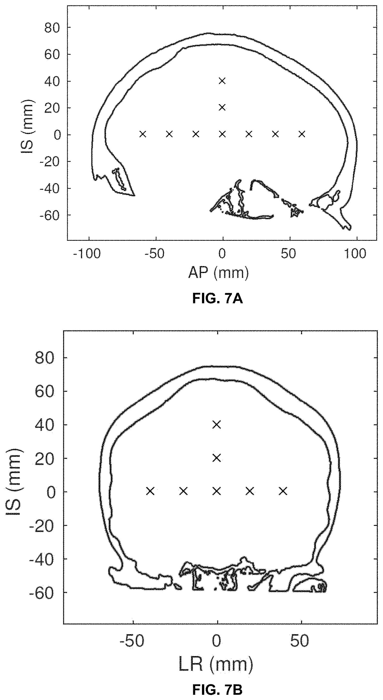 Patent US11793490 Figure 13 – Systems and methods for performing transcranial ultrasound therapeutic and imaging procedures