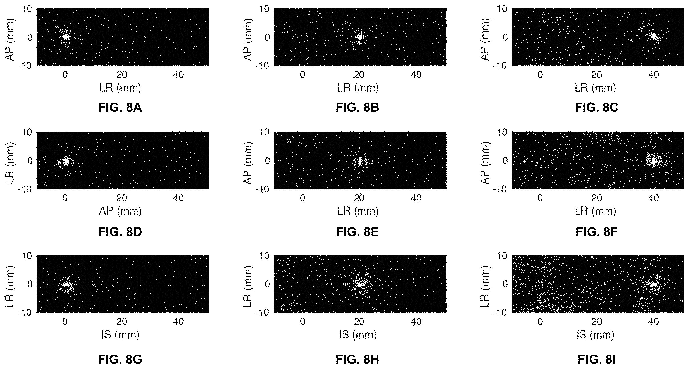 Patent US11793490 Figure 14 – Systems and methods for performing transcranial ultrasound therapeutic and imaging procedures