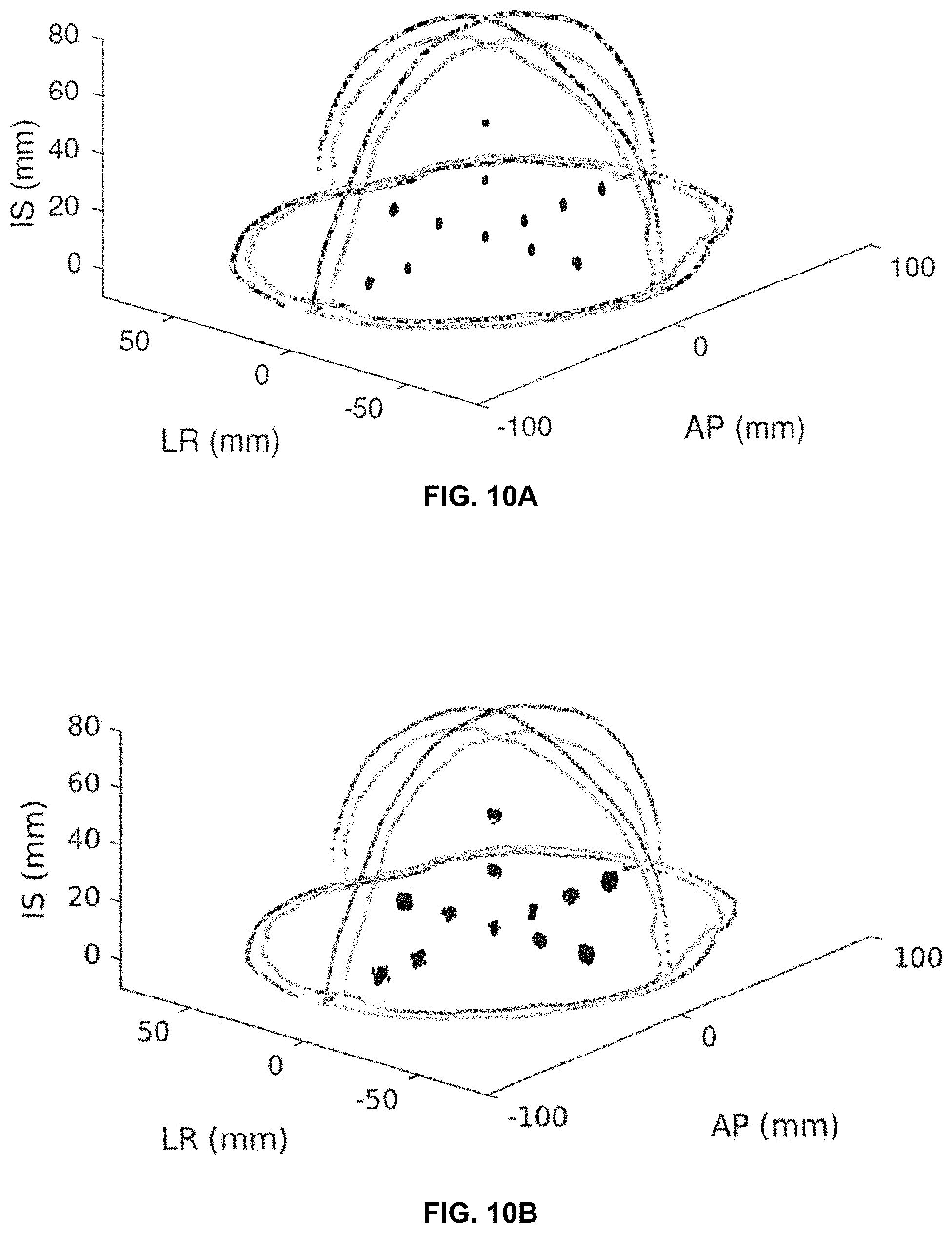 Patent US11793490 Figure 16 – Systems and methods for performing transcranial ultrasound therapeutic and imaging procedures