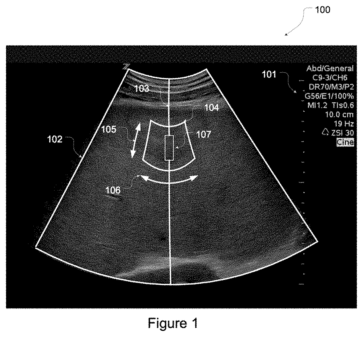 Patent US11793491 Figure 1 – Predictive use of quantitative imaging