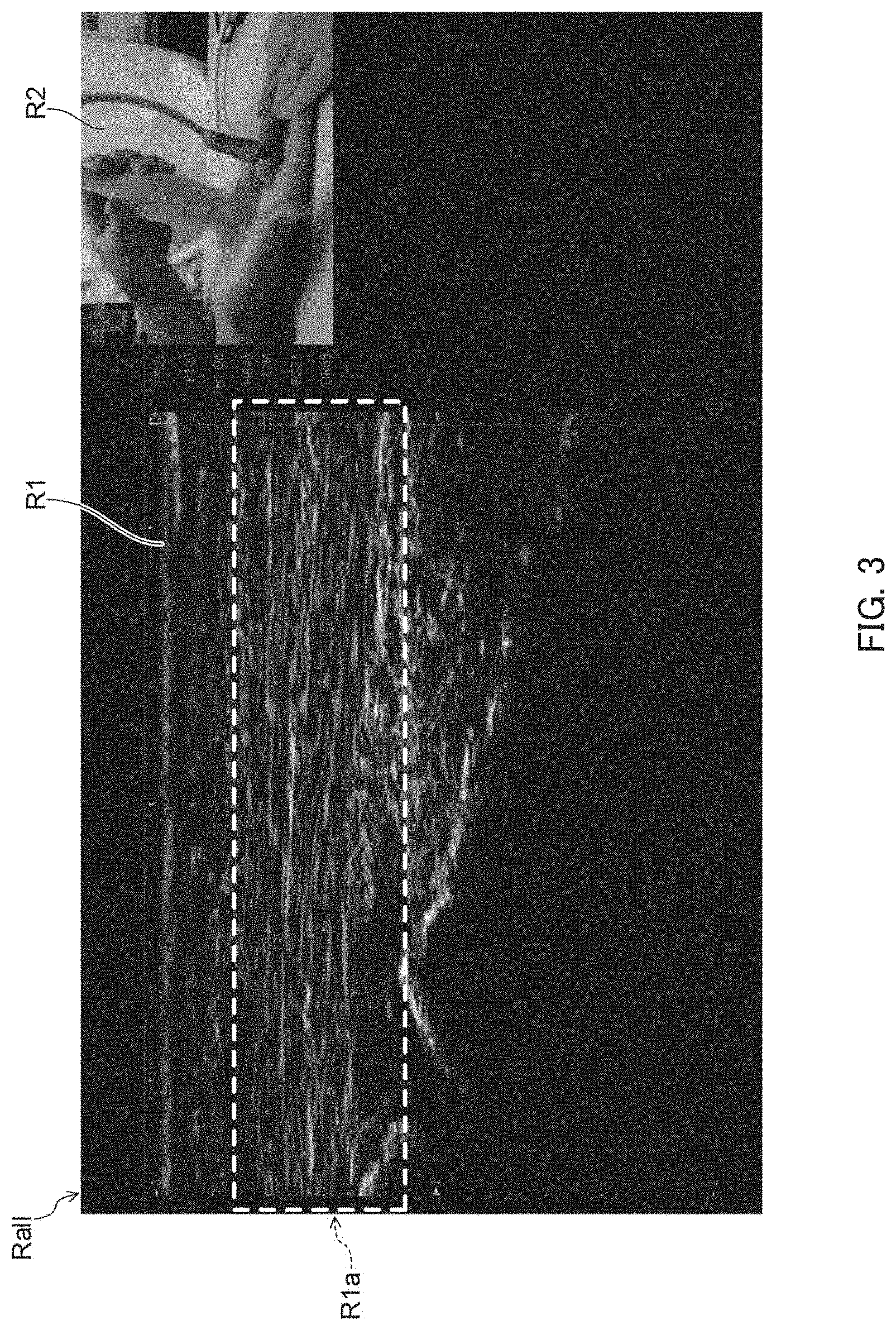 Patent US11793493 Figure 3 – Ultrasound diagnostic apparatus, control method for ultrasound diagnostic apparatus, and non-transitory computer-readable recording medium storing control program for ultrasound diagnostic apparatus