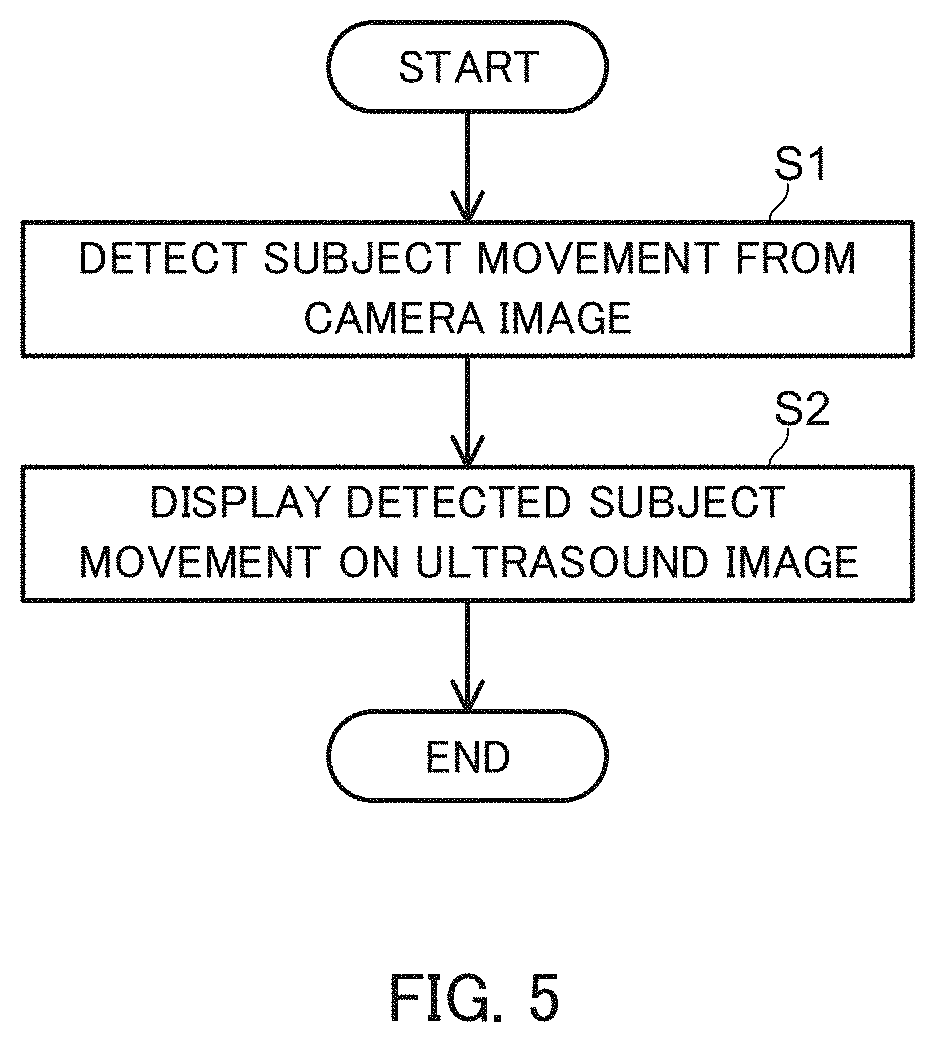 Patent US11793493 Figure 5 – Ultrasound diagnostic apparatus, control method for ultrasound diagnostic apparatus, and non-transitory computer-readable recording medium storing control program for ultrasound diagnostic apparatus
