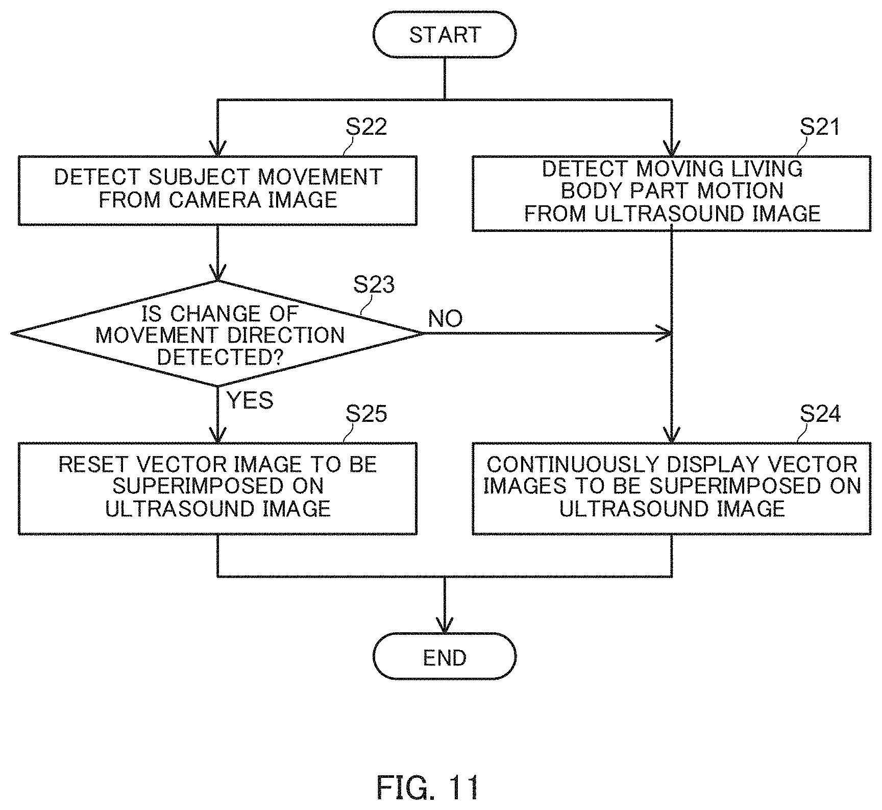 Patent US11793493 Figure 11 – Ultrasound diagnostic apparatus, control method for ultrasound diagnostic apparatus, and non-transitory computer-readable recording medium storing control program for ultrasound diagnostic apparatus