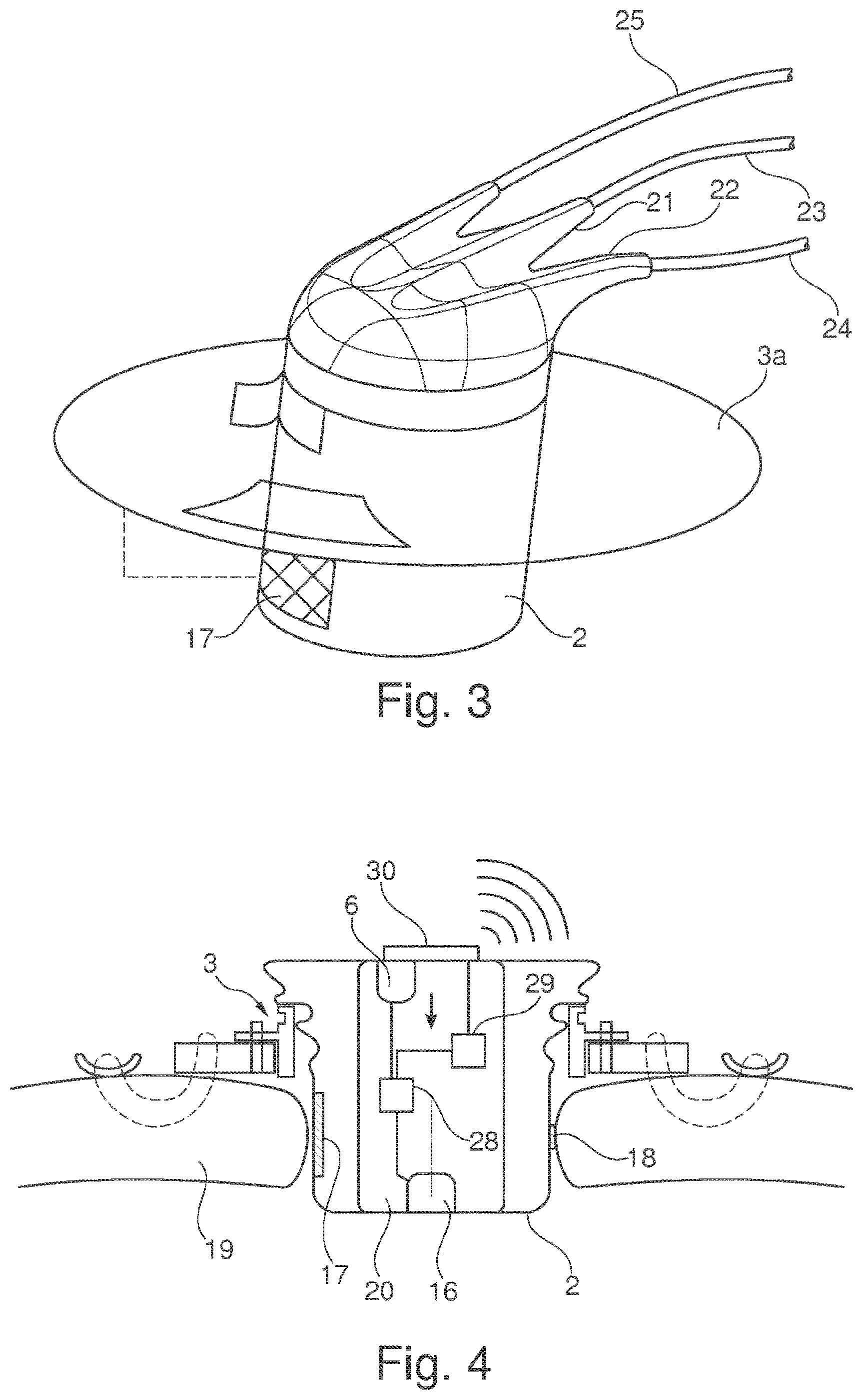 Patent US11793502 Figure 2 – Closing device for an opening in the heart of a patient