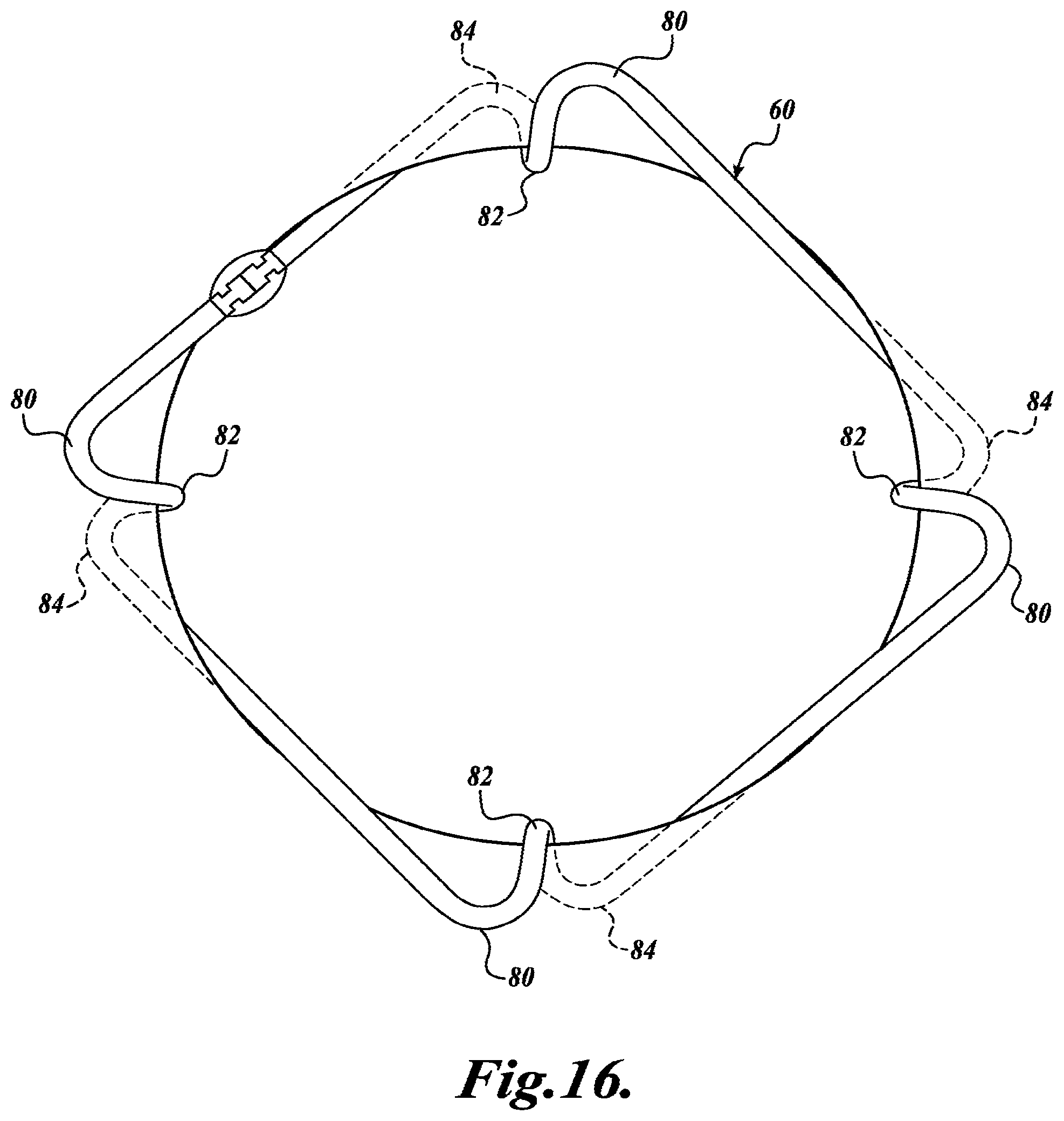 Patent US11793503 Figure 11 – Expansion ring for eyeball tissue