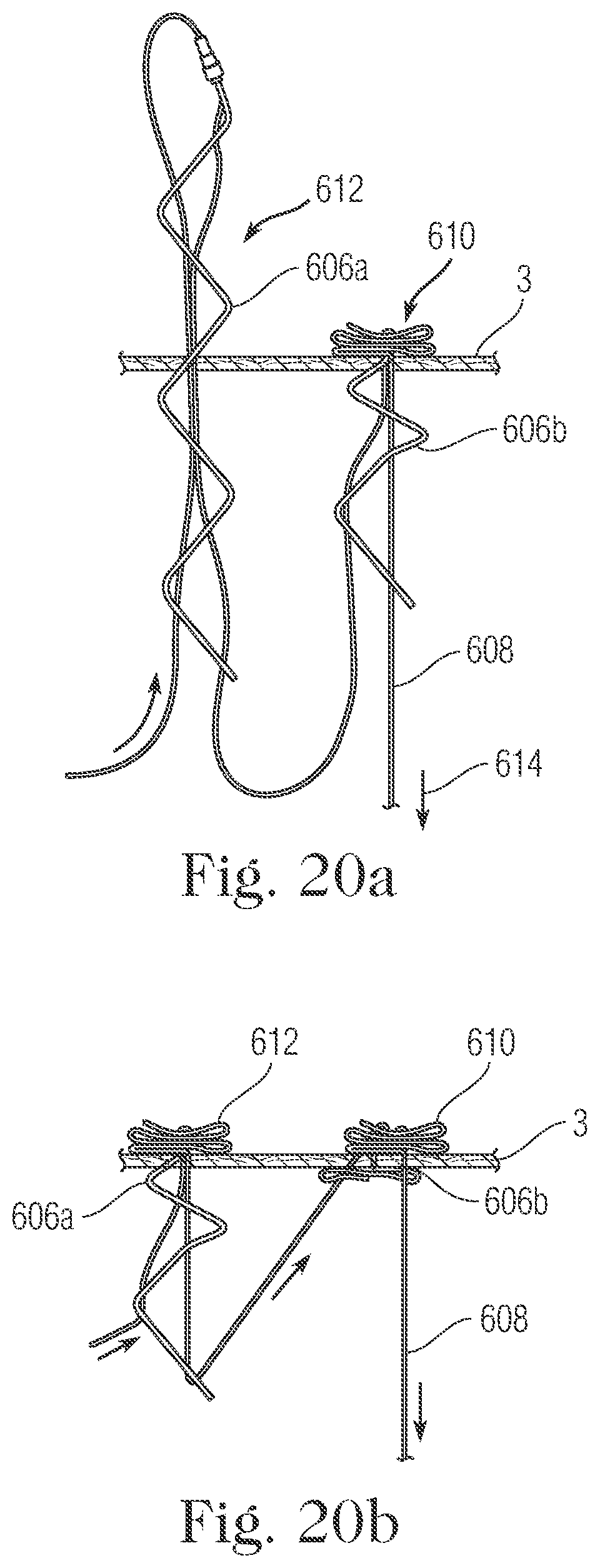 Patent US11793505 Figure 19 – Devices and methods for percutaneous tricuspid valve repair