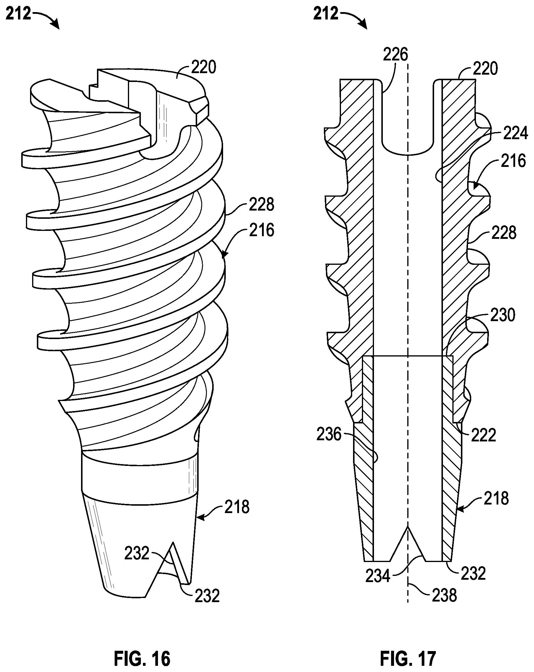 Patent US11793506 Figure 13 – Suture anchor system and method