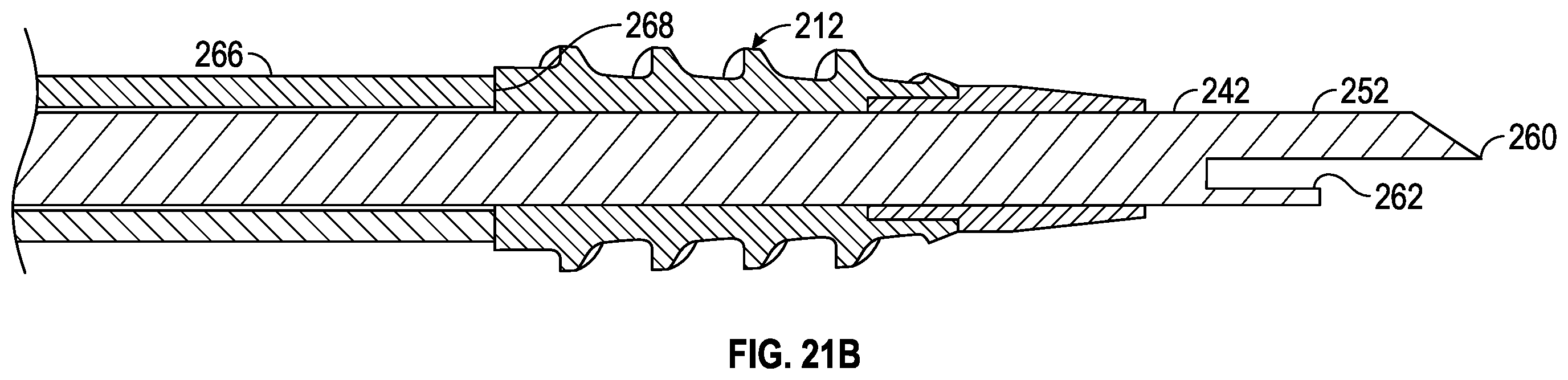 Patent US11793506 Figure 16 – Suture anchor system and method