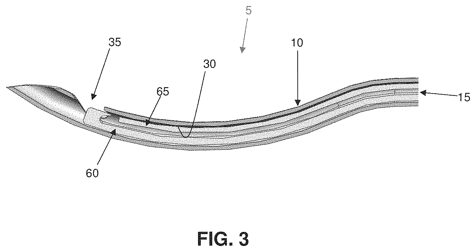 Patent US11793507 Figure 3 – Method and apparatus for passing suture through tissue