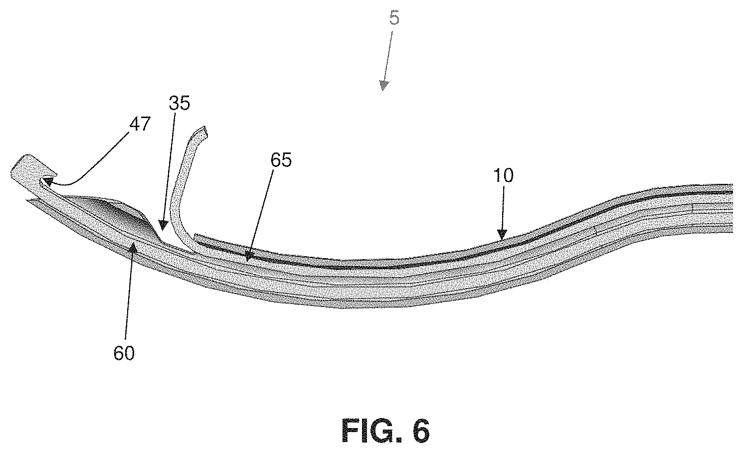 Patent US11793507 Figure 6 – Method and apparatus for passing suture through tissue