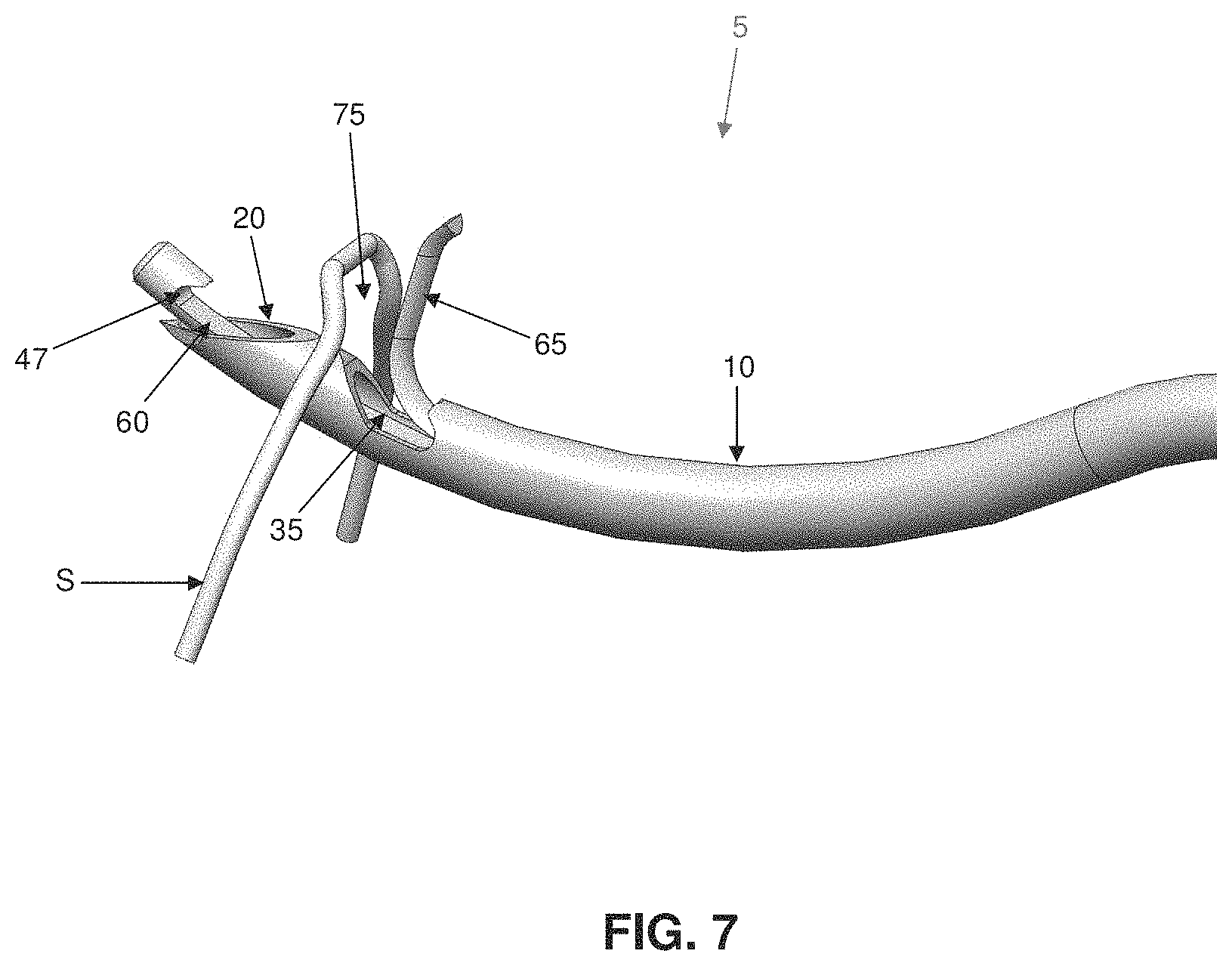 Patent US11793507 Figure 7 – Method and apparatus for passing suture through tissue