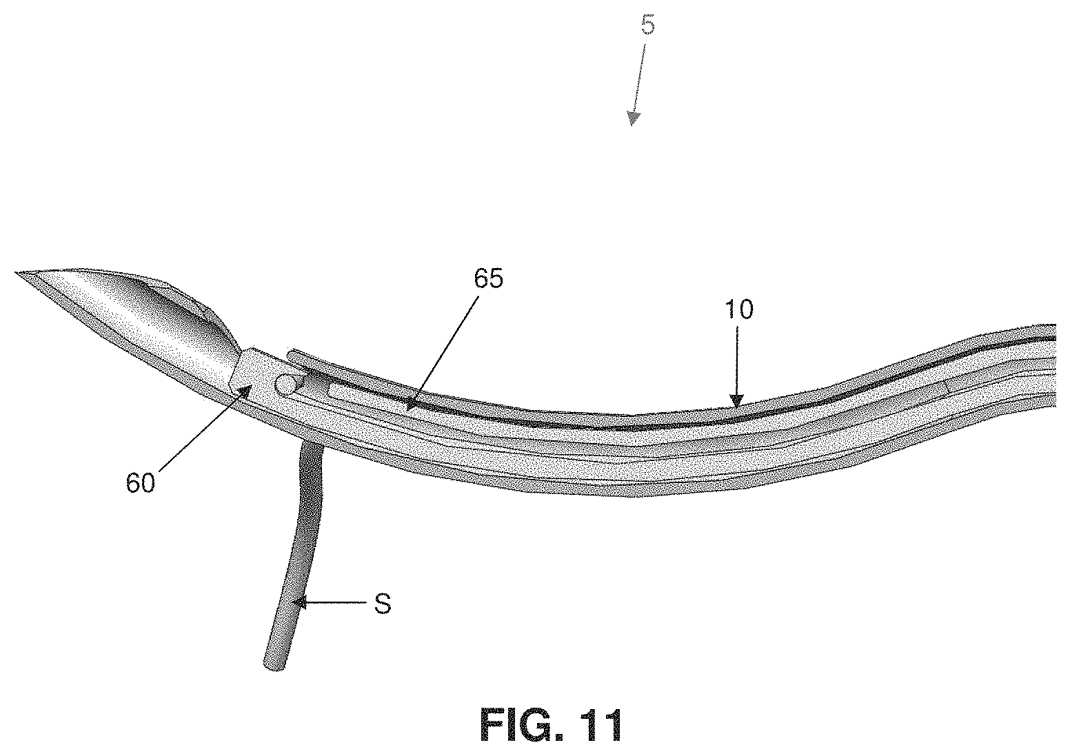 Patent US11793507 Figure 10 – Method and apparatus for passing suture through tissue