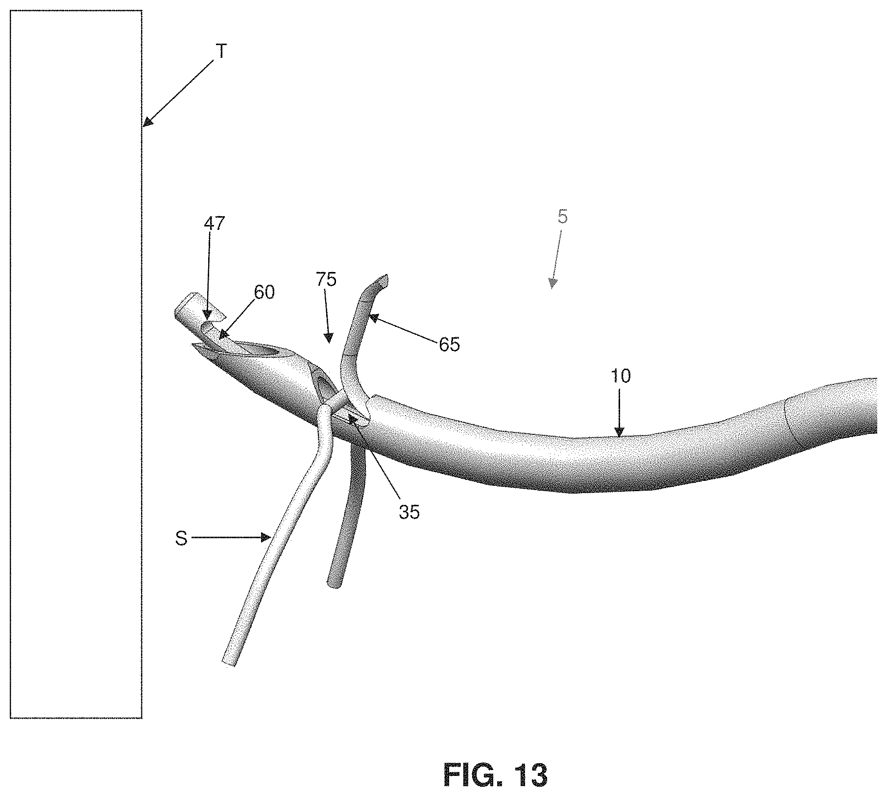 Patent US11793507 Figure 12 – Method and apparatus for passing suture through tissue