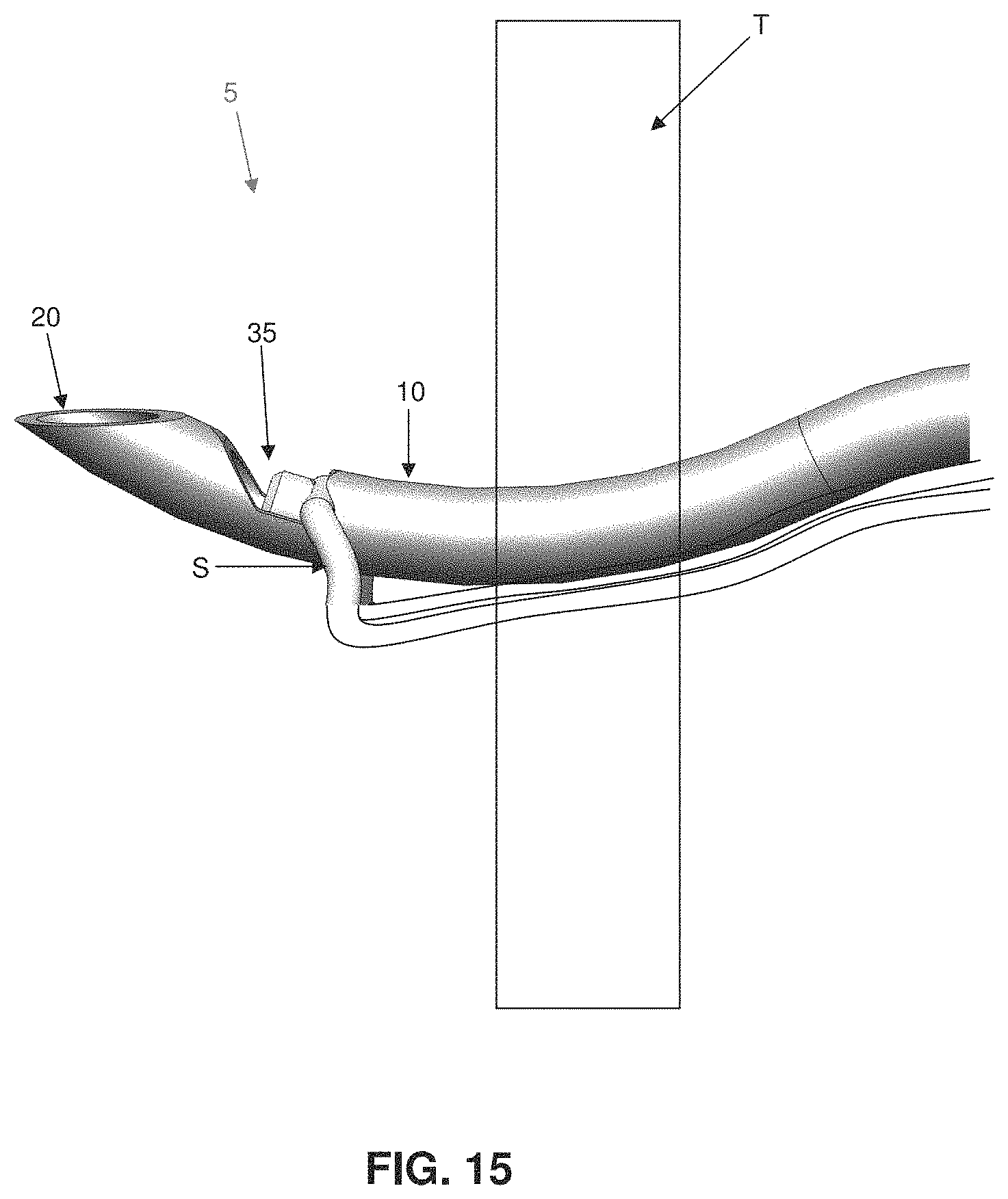 Patent US11793507 Figure 14 – Method and apparatus for passing suture through tissue
