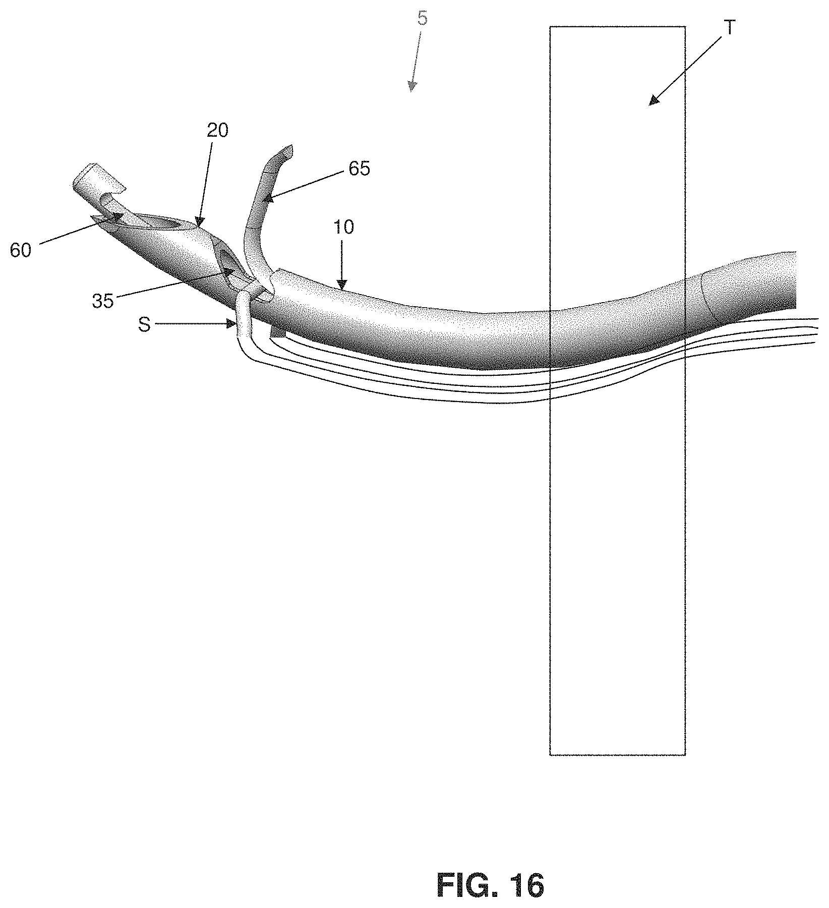 Patent US11793507 Figure 15 – Method and apparatus for passing suture through tissue