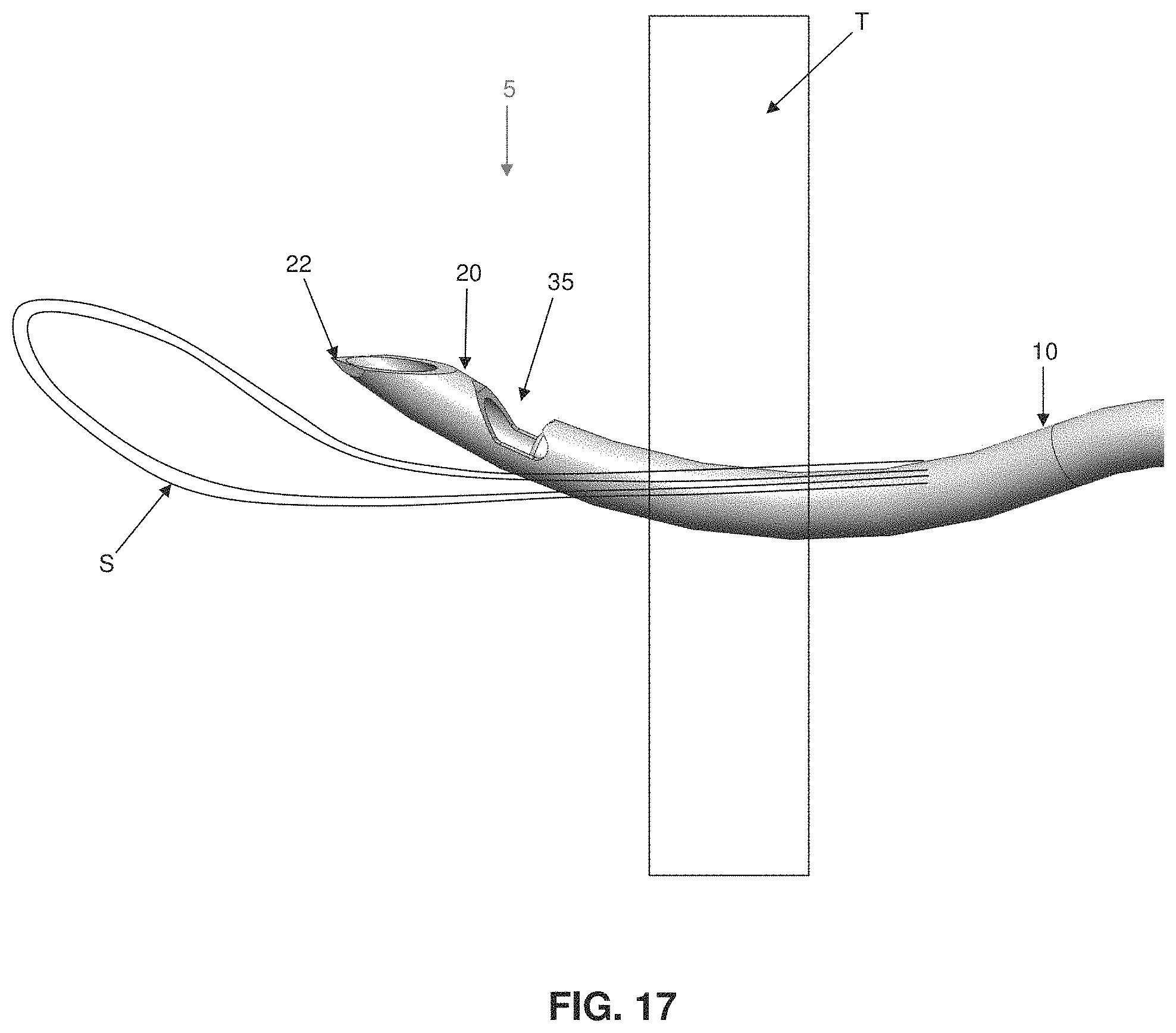 Patent US11793507 Figure 16 – Method and apparatus for passing suture through tissue
