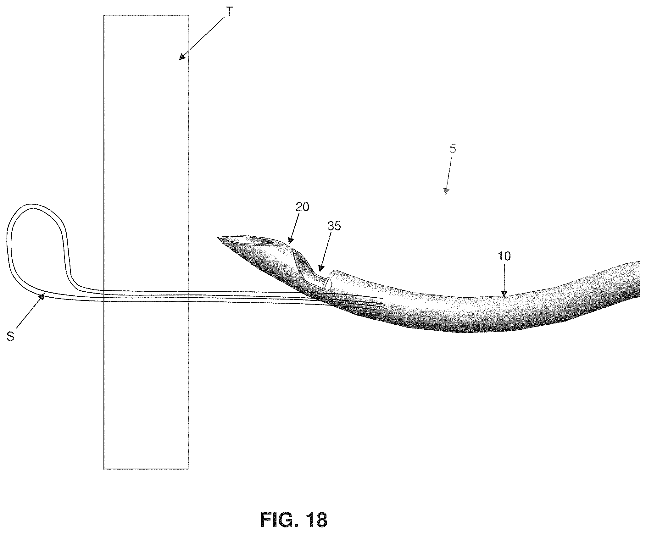 Patent US11793507 Figure 17 – Method and apparatus for passing suture through tissue