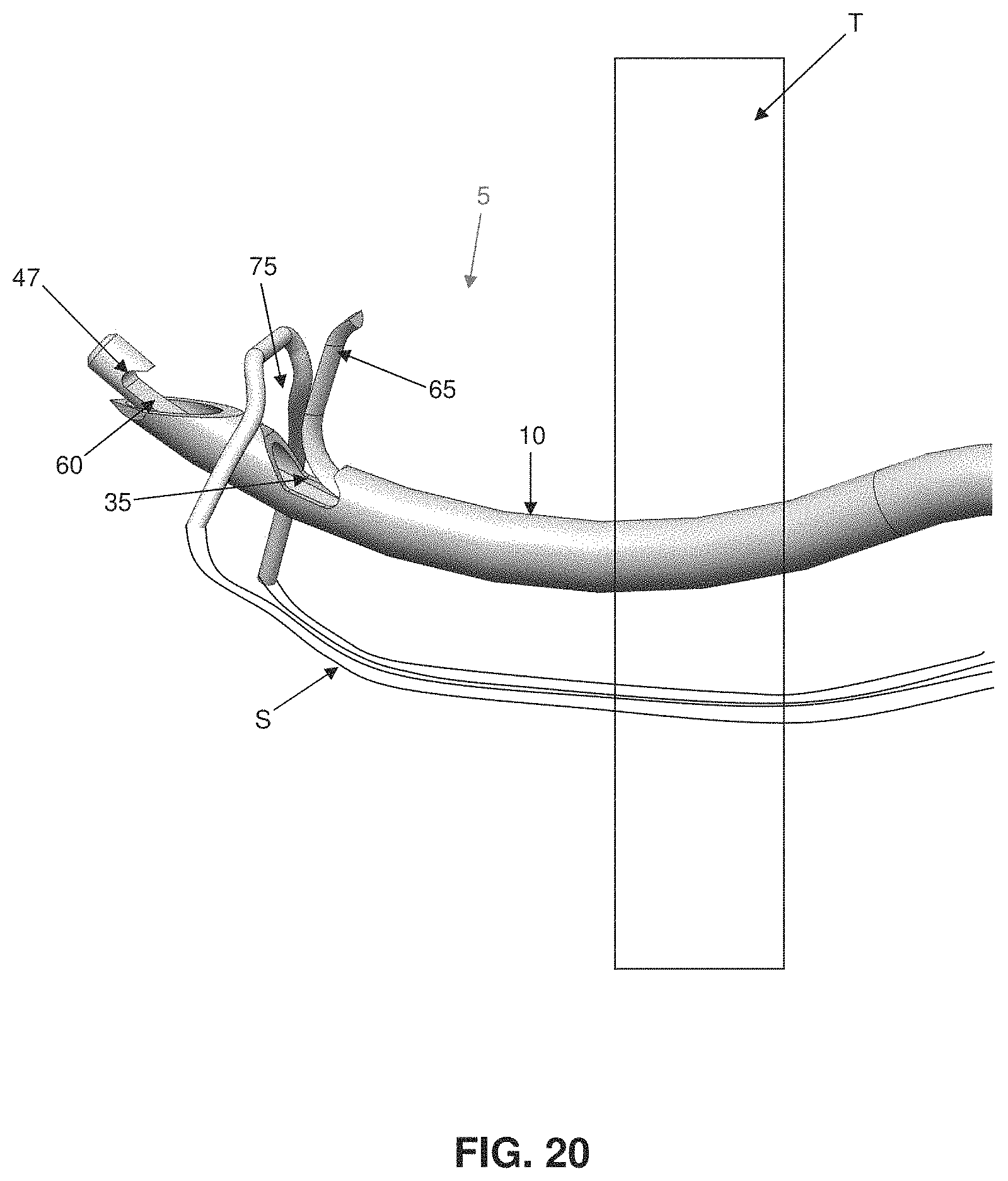 Patent US11793507 Figure 19 – Method and apparatus for passing suture through tissue
