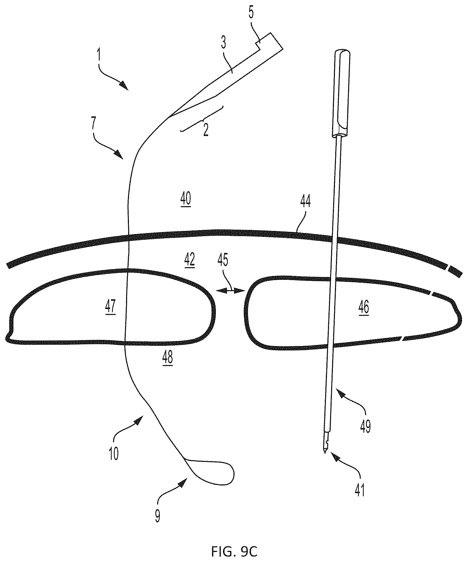 Patent US11793508 Figure 8 – Systems, devices and methods for tissue fixation and approximating tissue defects