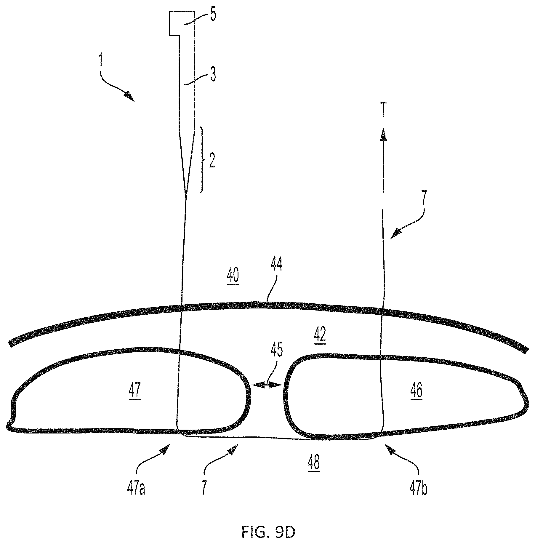 Patent US11793508 Figure 9 – Systems, devices and methods for tissue fixation and approximating tissue defects