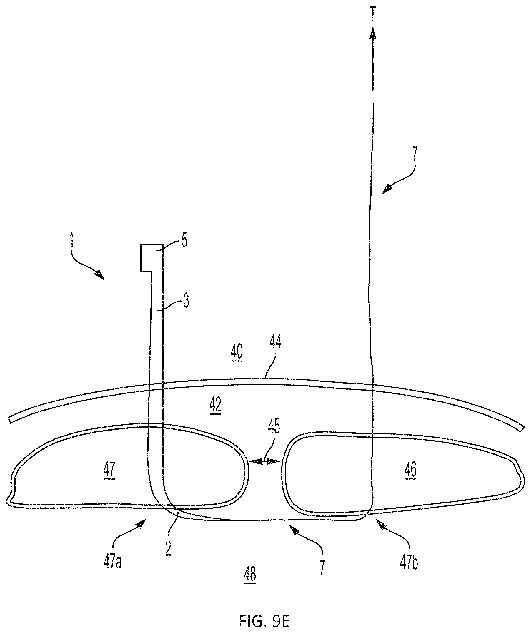 Patent US11793508 Figure 10 – Systems, devices and methods for tissue fixation and approximating tissue defects