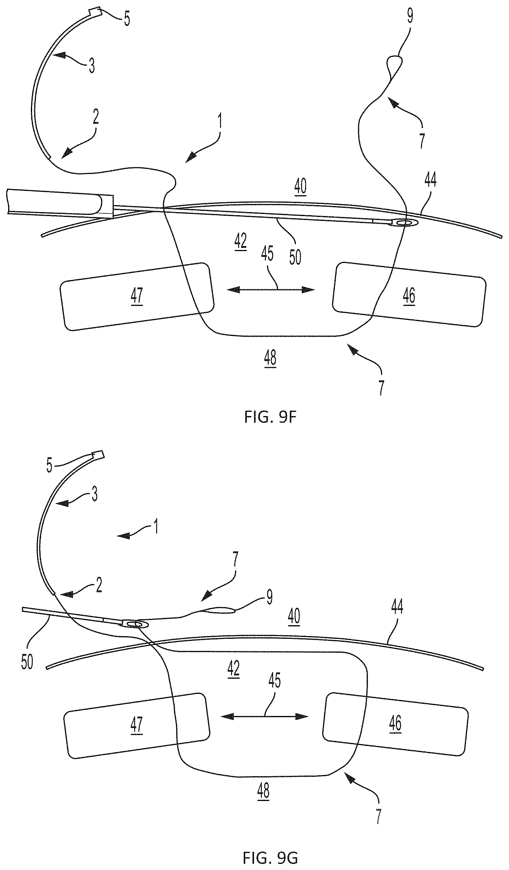 Patent US11793508 Figure 11 – Systems, devices and methods for tissue fixation and approximating tissue defects