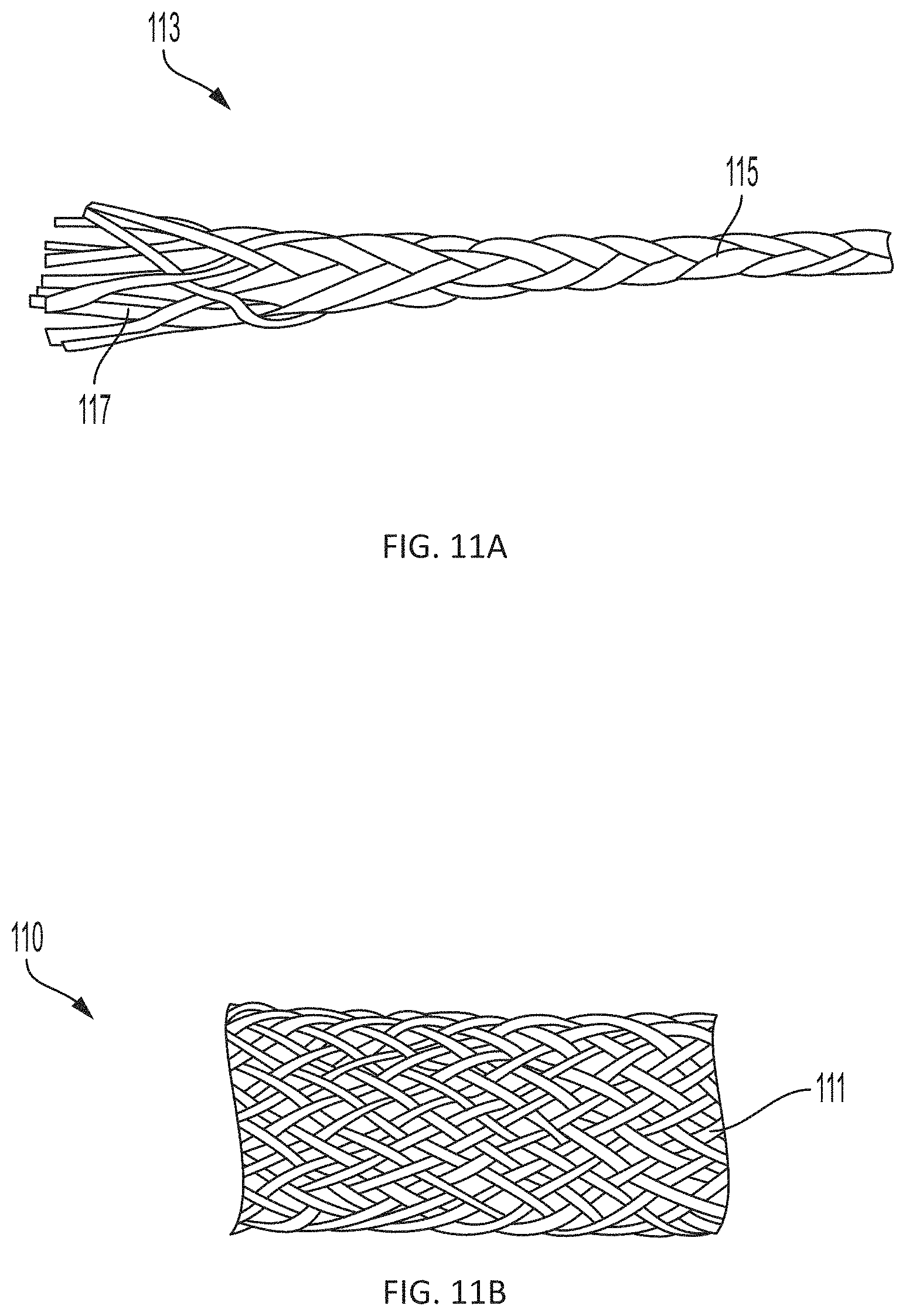 Patent US11793508 Figure 15 – Systems, devices and methods for tissue fixation and approximating tissue defects