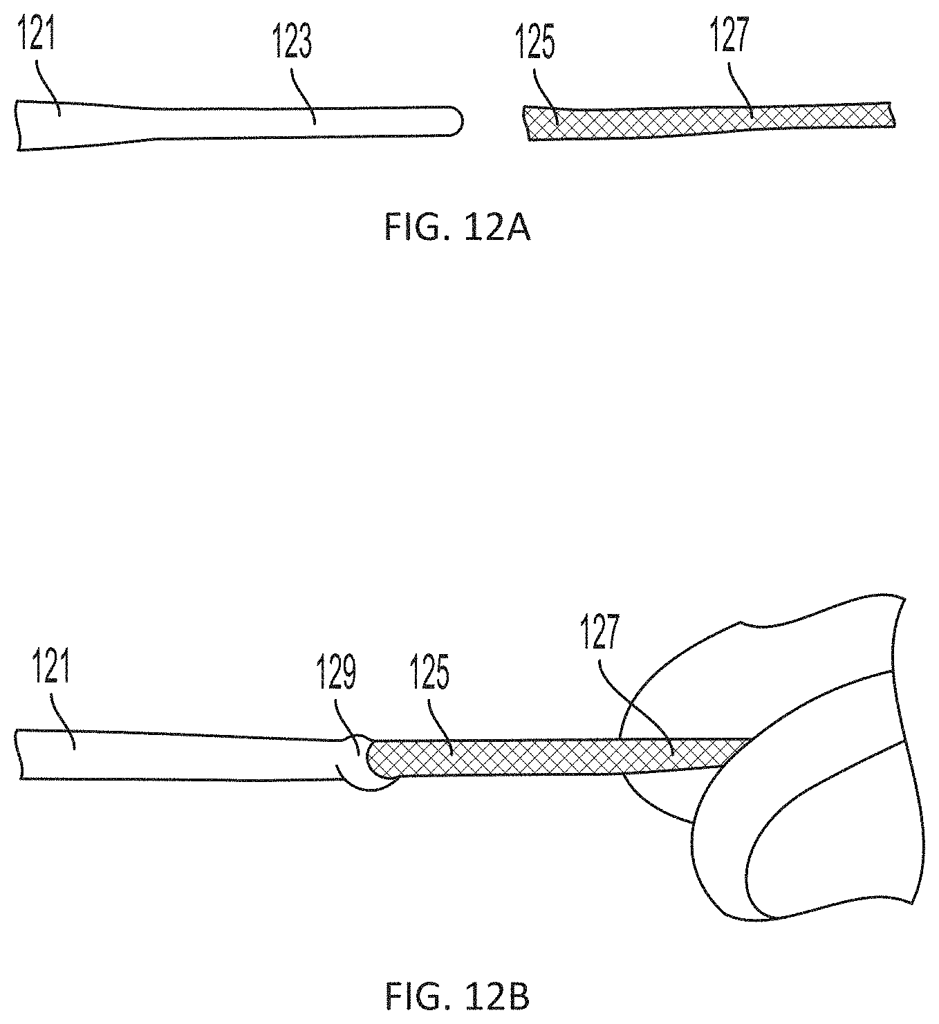 Patent US11793508 Figure 16 – Systems, devices and methods for tissue fixation and approximating tissue defects