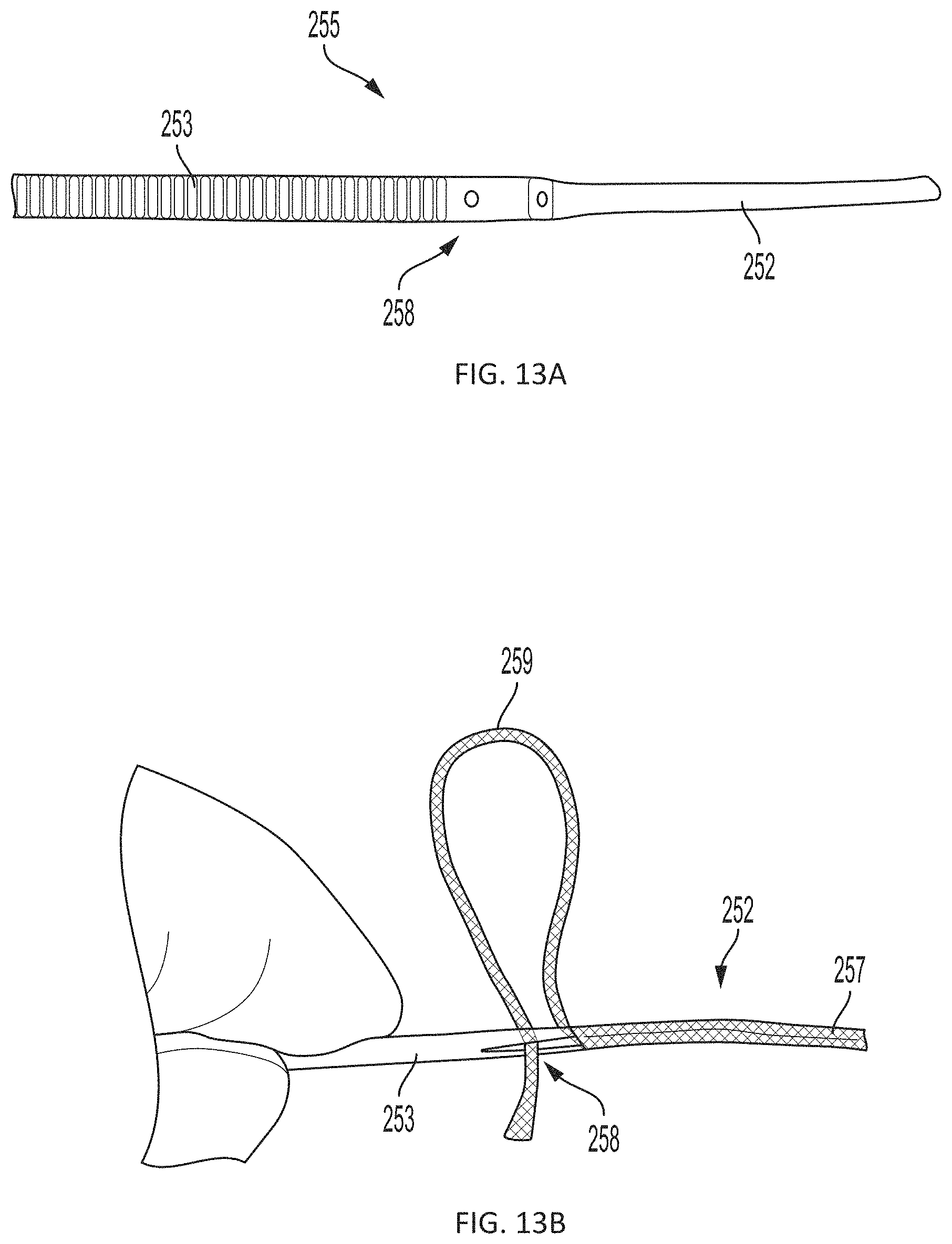 Patent US11793508 Figure 17 – Systems, devices and methods for tissue fixation and approximating tissue defects