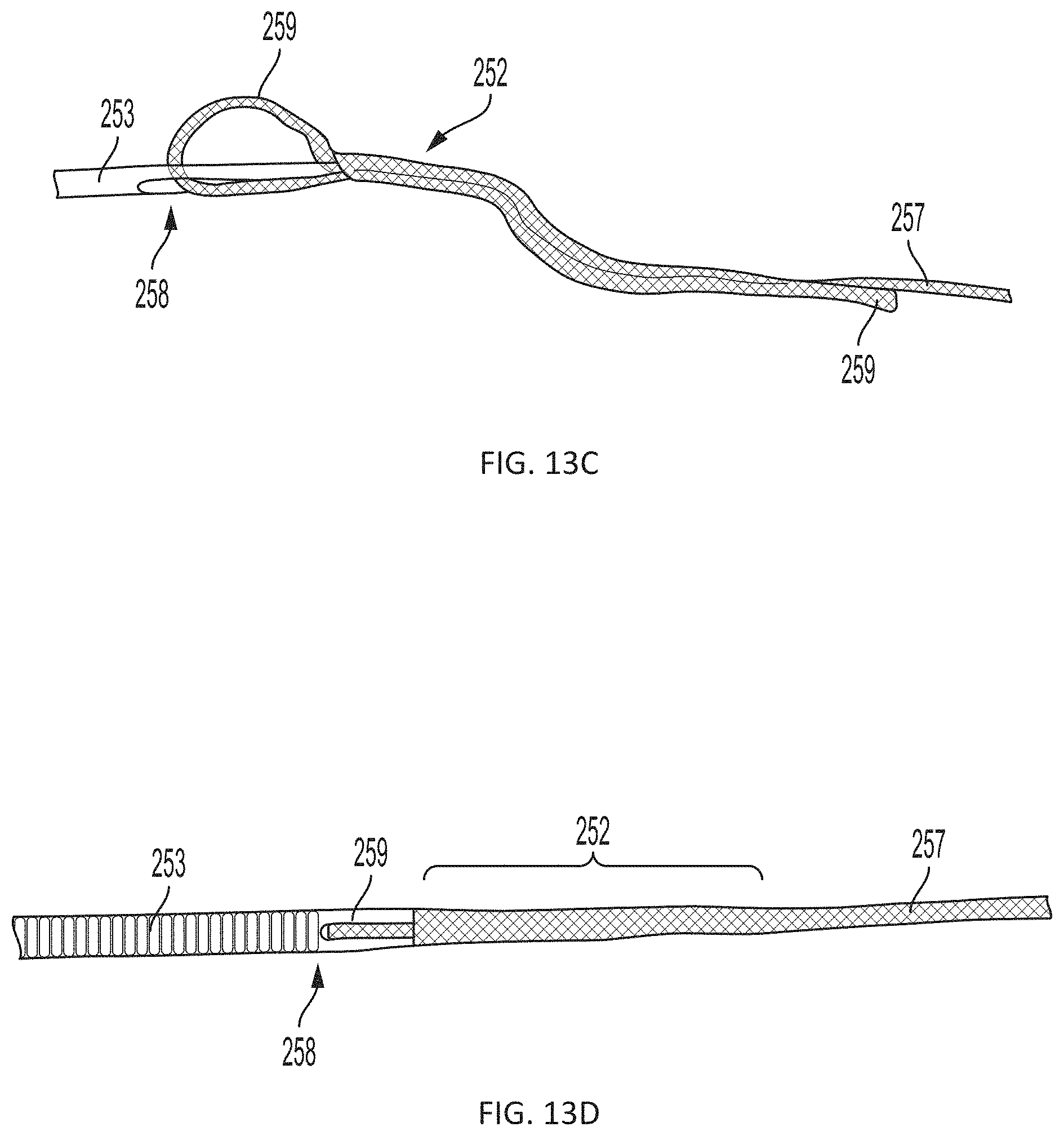 Patent US11793508 Figure 18 – Systems, devices and methods for tissue fixation and approximating tissue defects