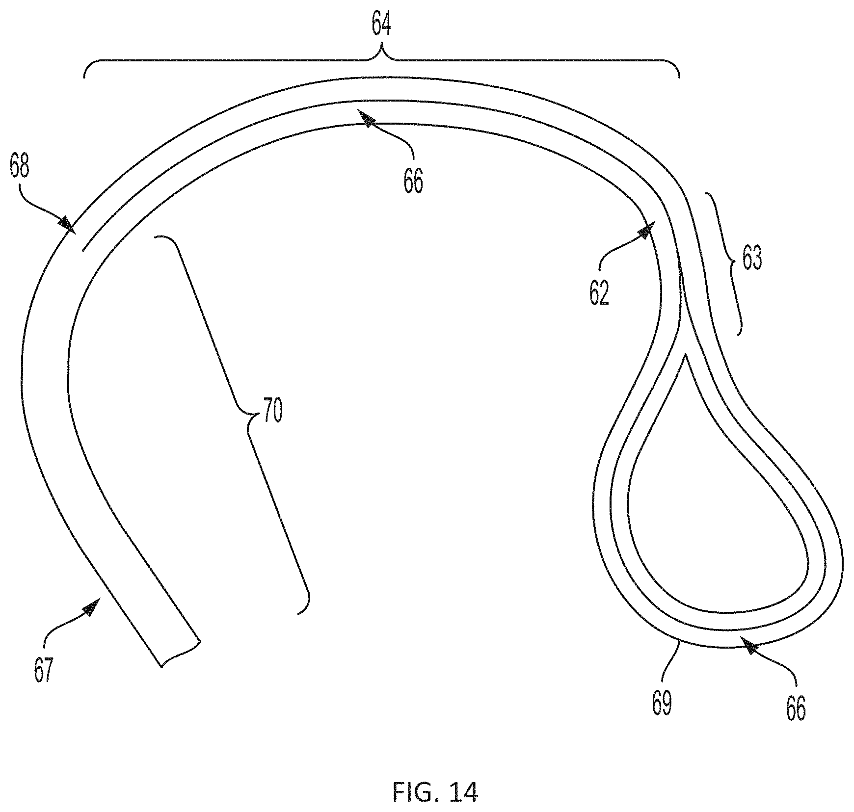 Patent US11793508 Figure 19 – Systems, devices and methods for tissue fixation and approximating tissue defects