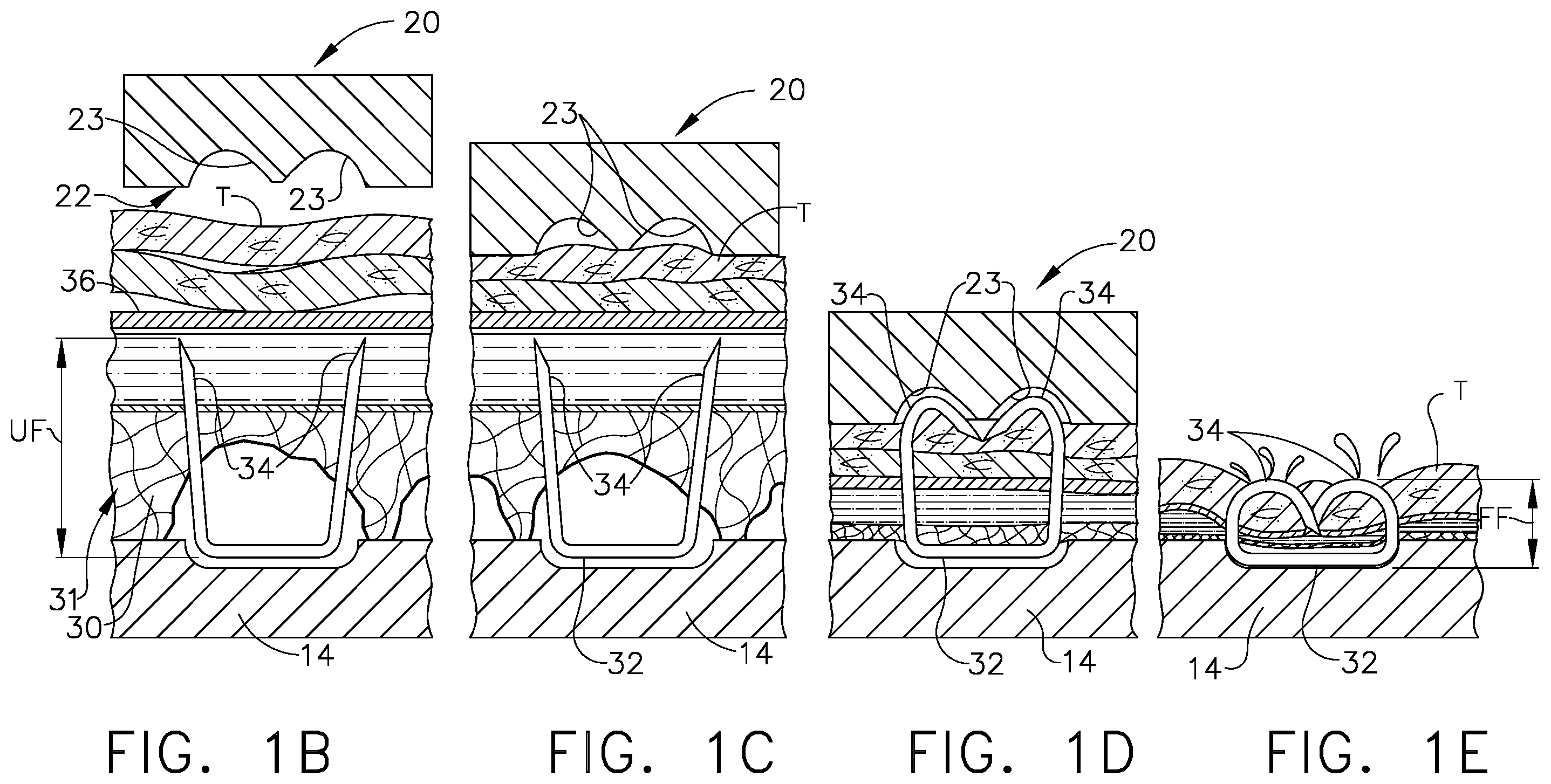 Patent US11793509 Figure 3 – Staple cartridge including an implantable layer