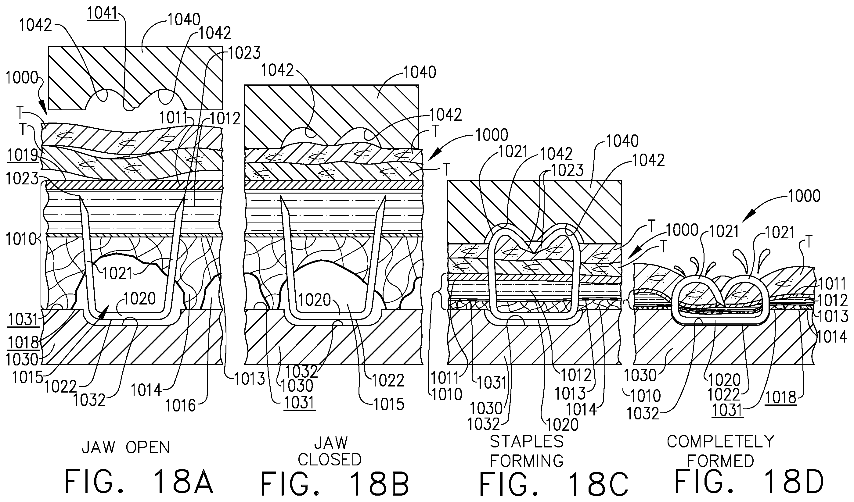 Patent US11793509 Figure 11 – Staple cartridge including an implantable layer