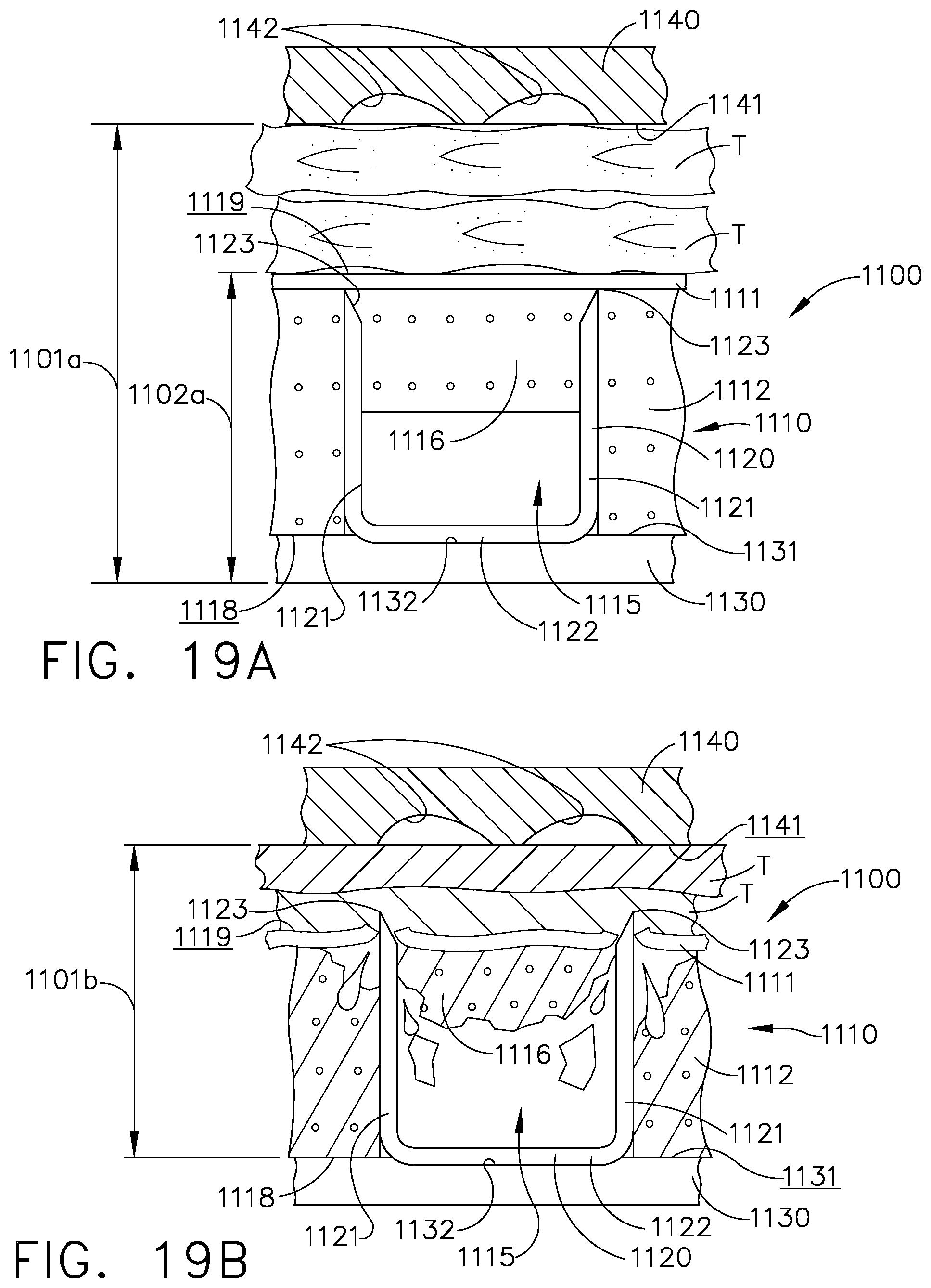 Patent US11793509 Figure 12 – Staple cartridge including an implantable layer