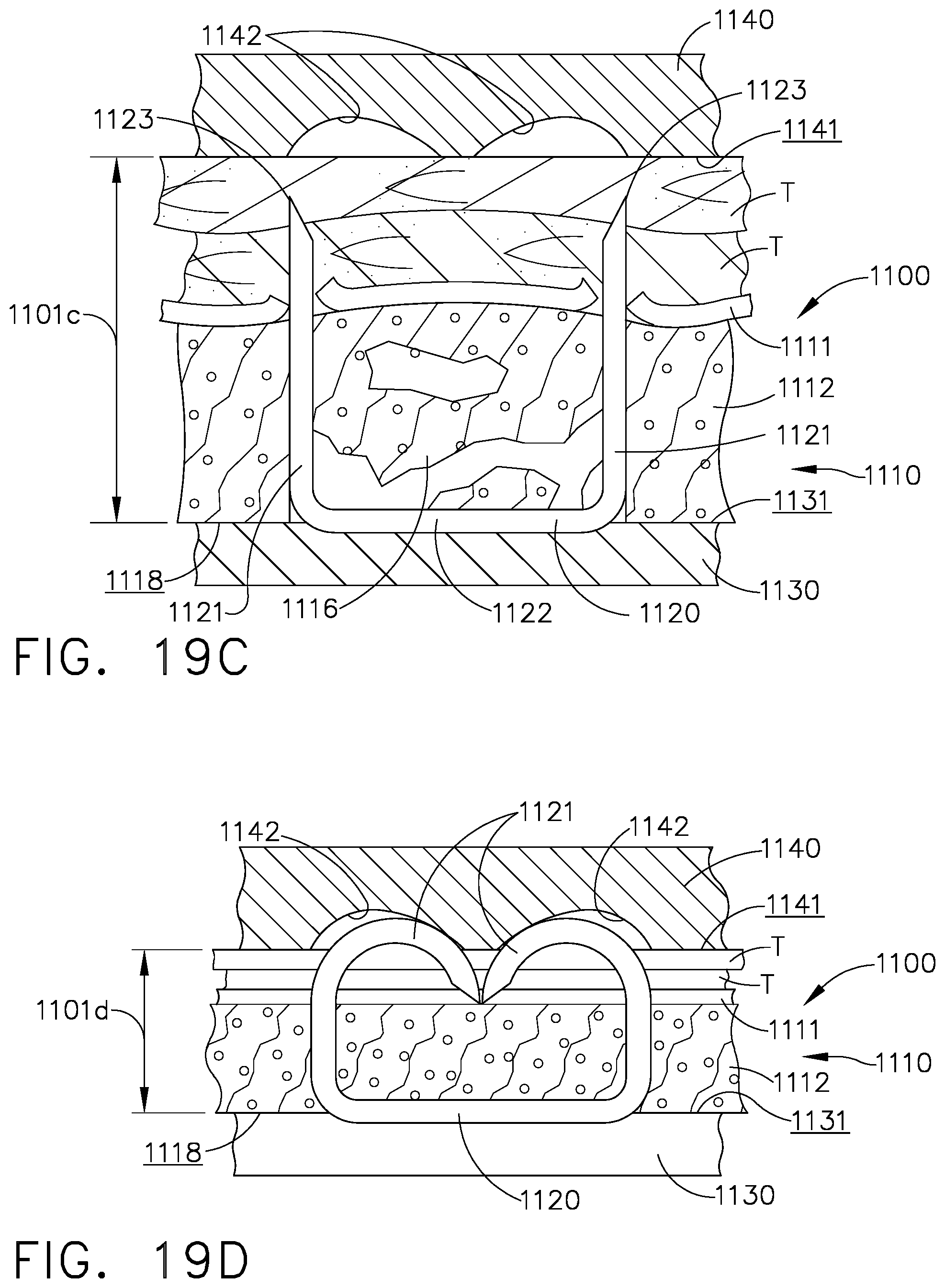 Patent US11793509 Figure 13 – Staple cartridge including an implantable layer