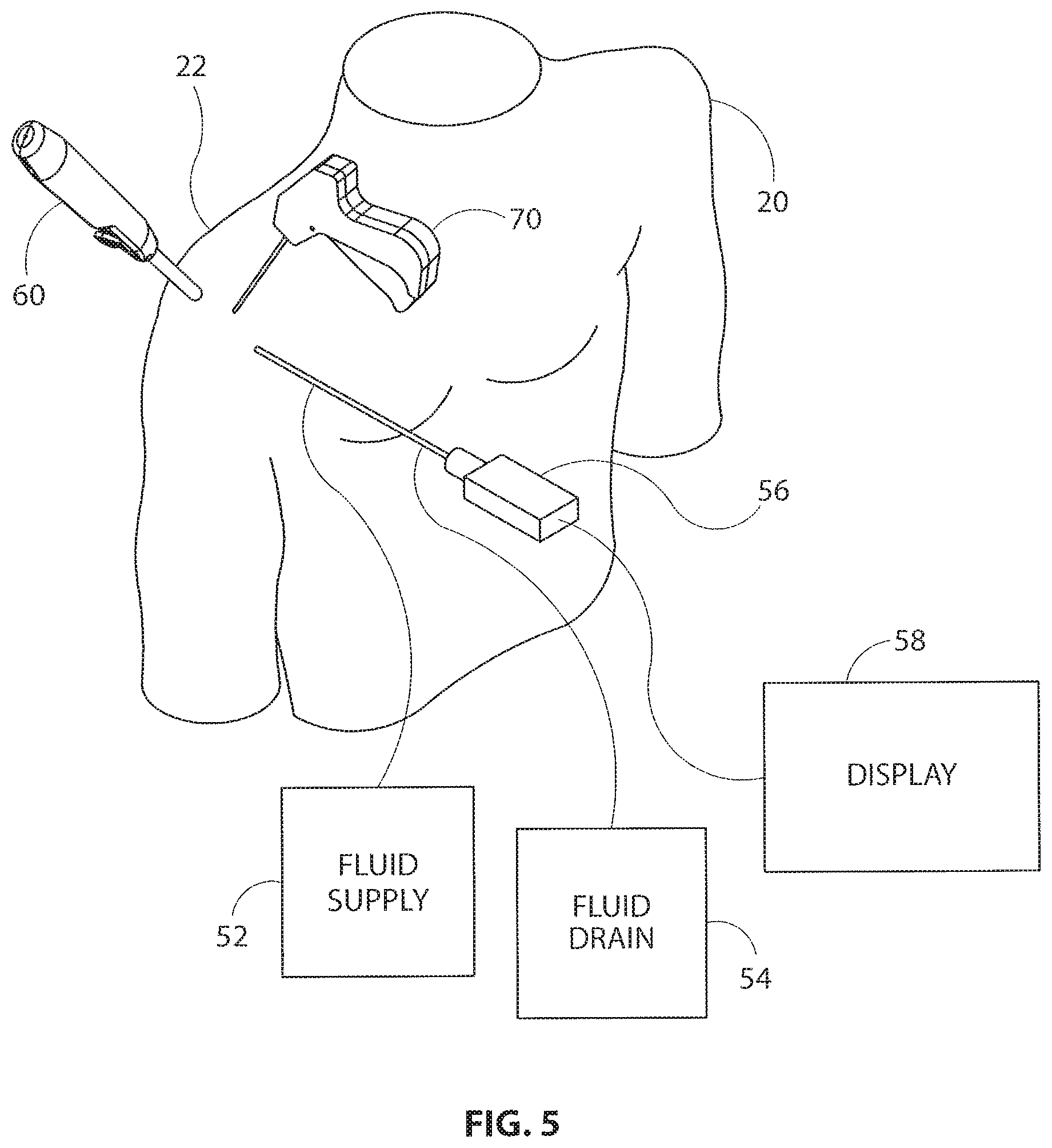 Patent US11793510 Figure 4 – Methods and apparatus for delivering staples to a target tissue