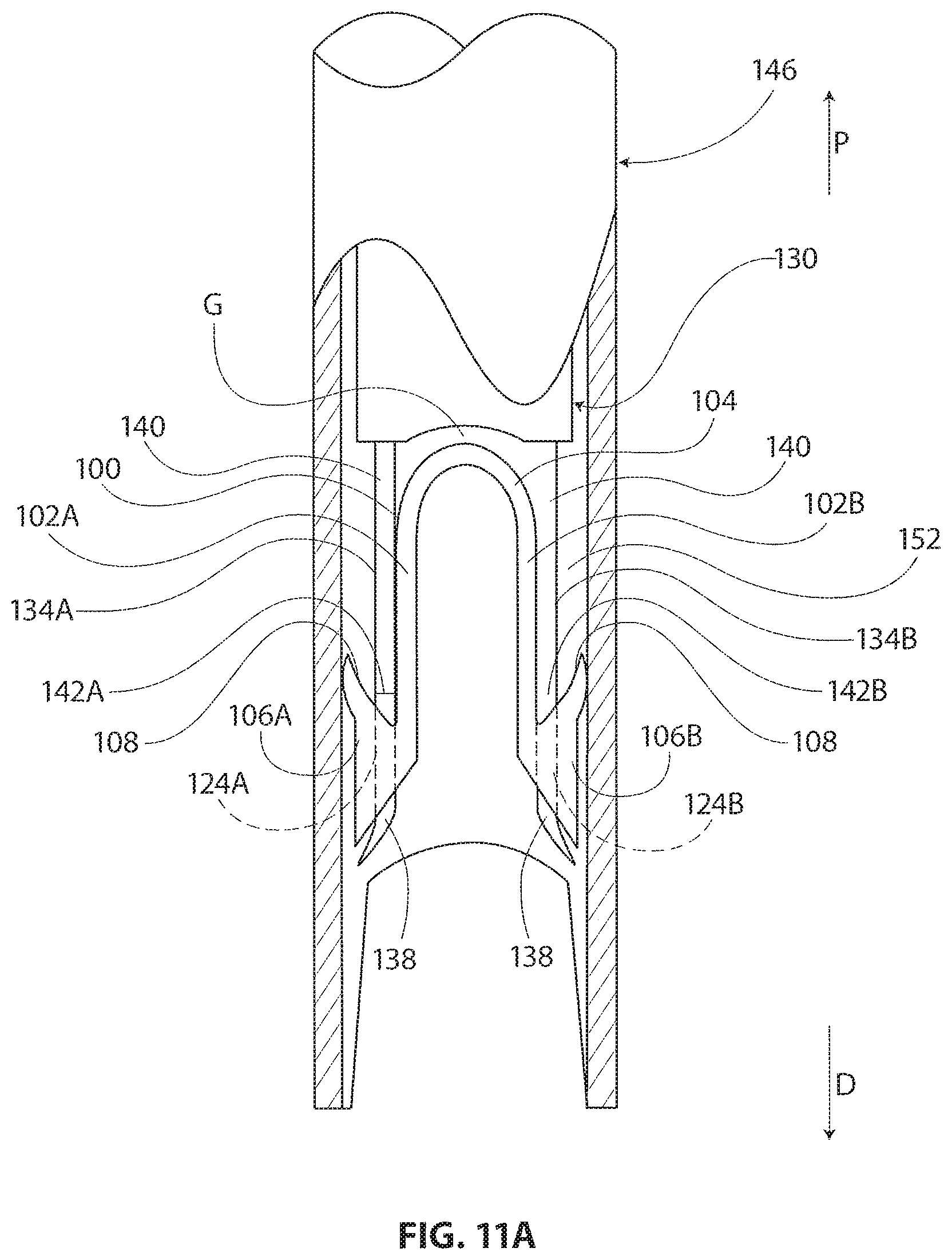Patent US11793510 Figure 10 – Methods and apparatus for delivering staples to a target tissue