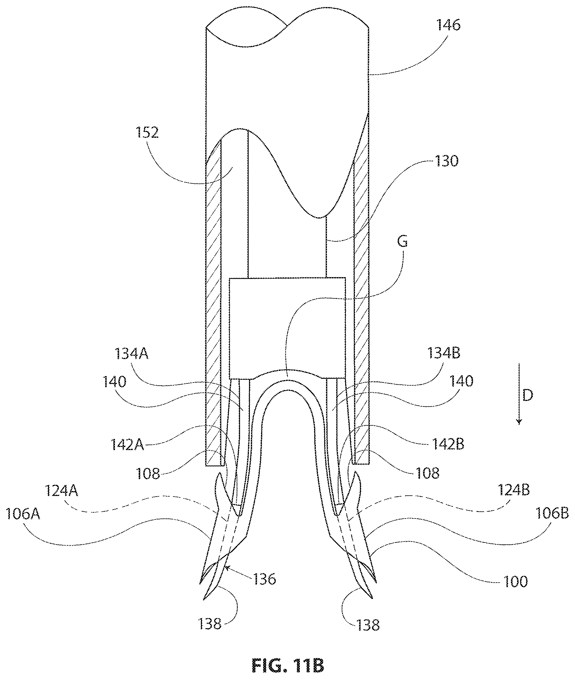 Patent US11793510 Figure 11 – Methods and apparatus for delivering staples to a target tissue