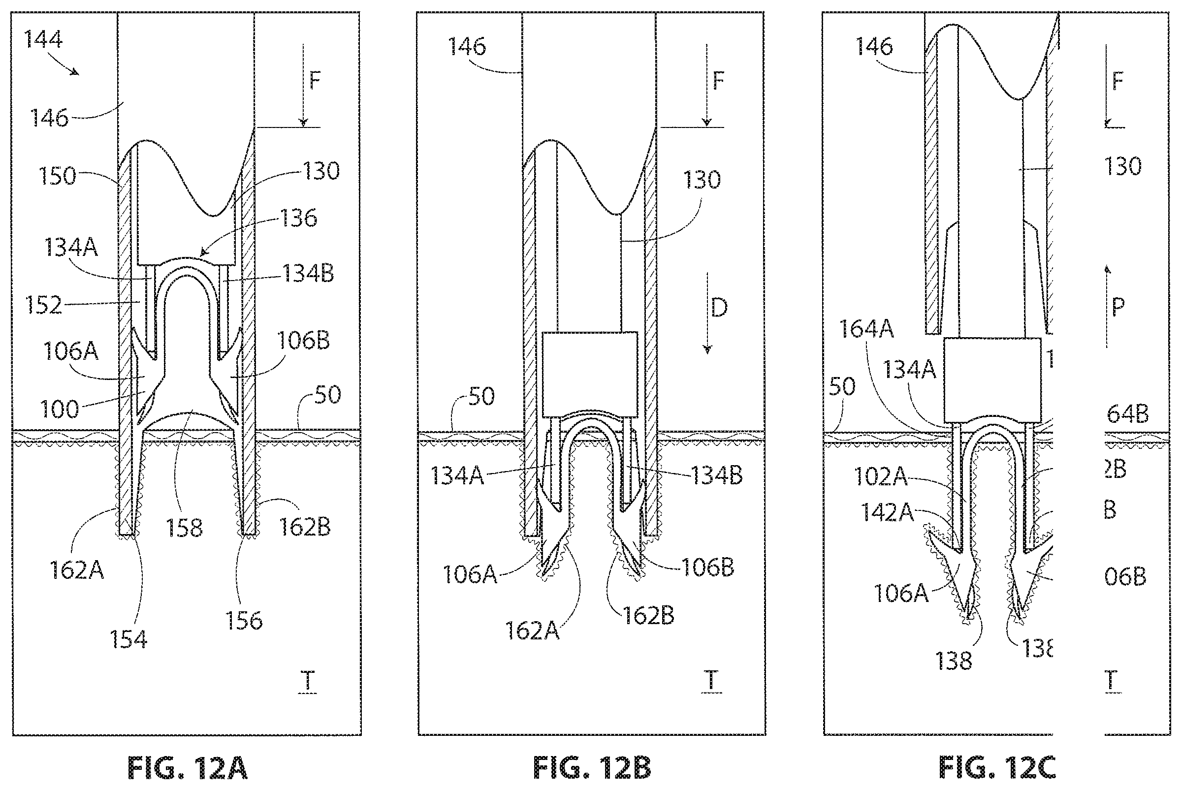 Patent US11793510 Figure 12 – Methods and apparatus for delivering staples to a target tissue