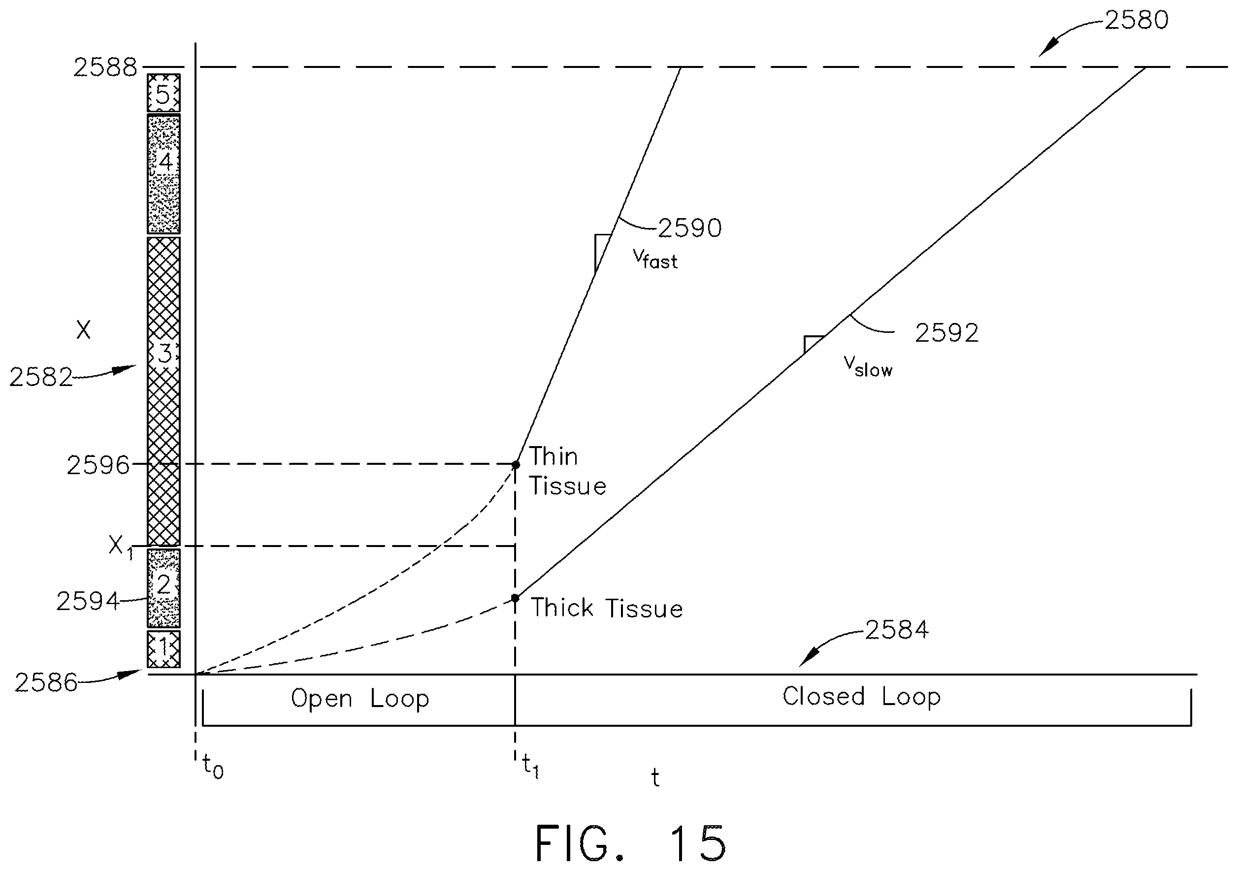 Patent US11793513 Figure 14 – Systems and methods for controlling motor speed according to user input for a surgical instrument