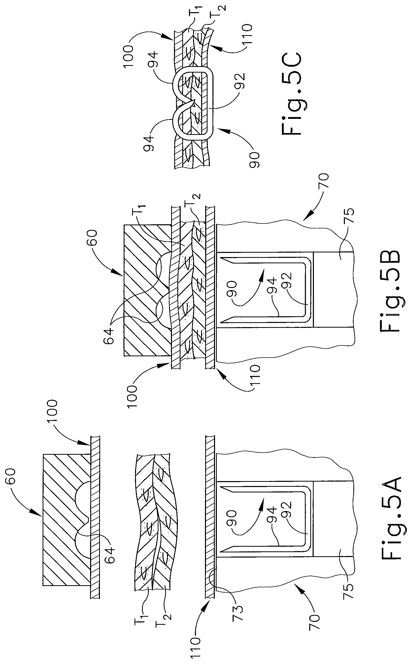 Patent US11793515 Figure 5 – Surgical stapler buttress assembly with adhesion to wet end effector