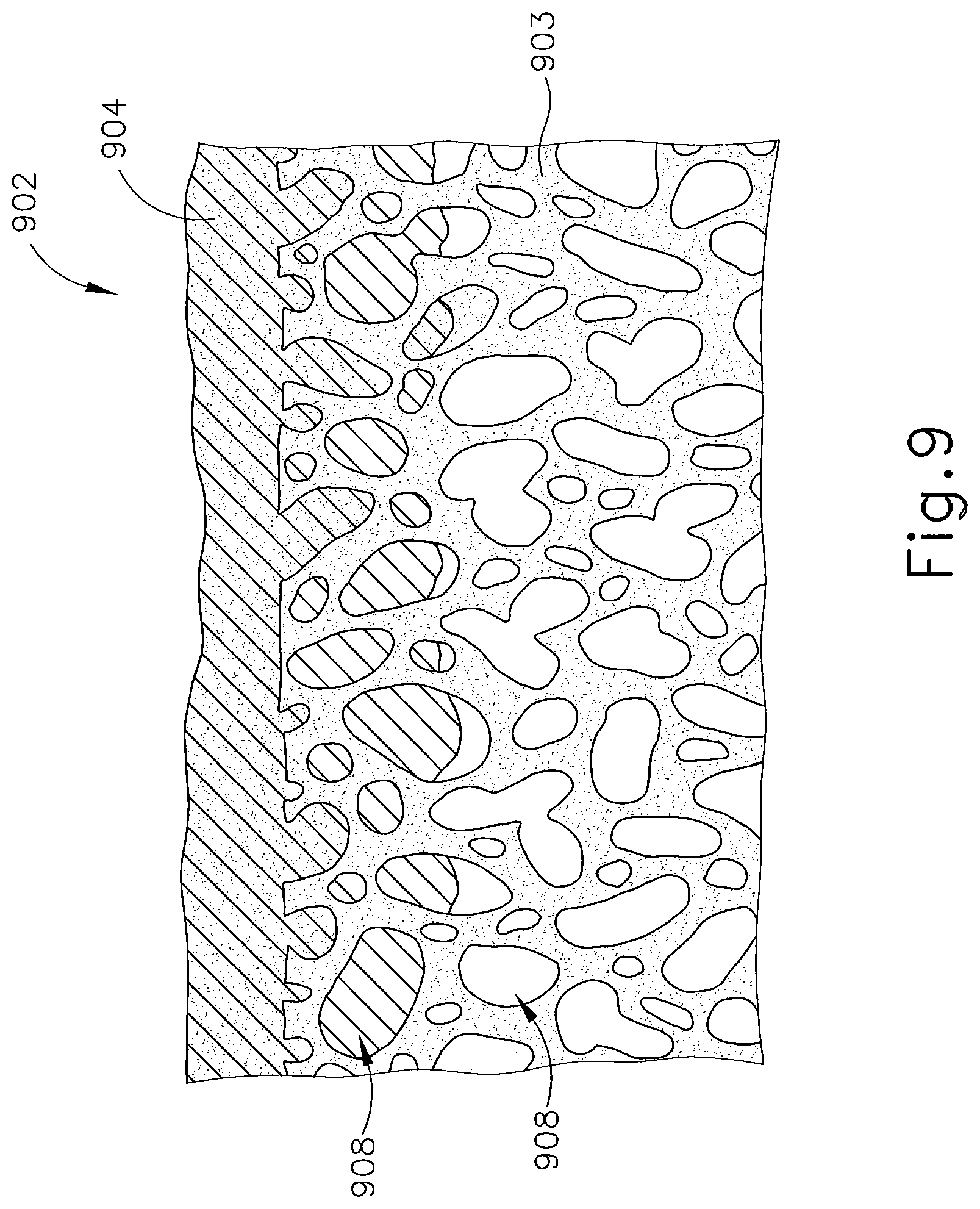 Patent US11793515 Figure 9 – Surgical stapler buttress assembly with adhesion to wet end effector